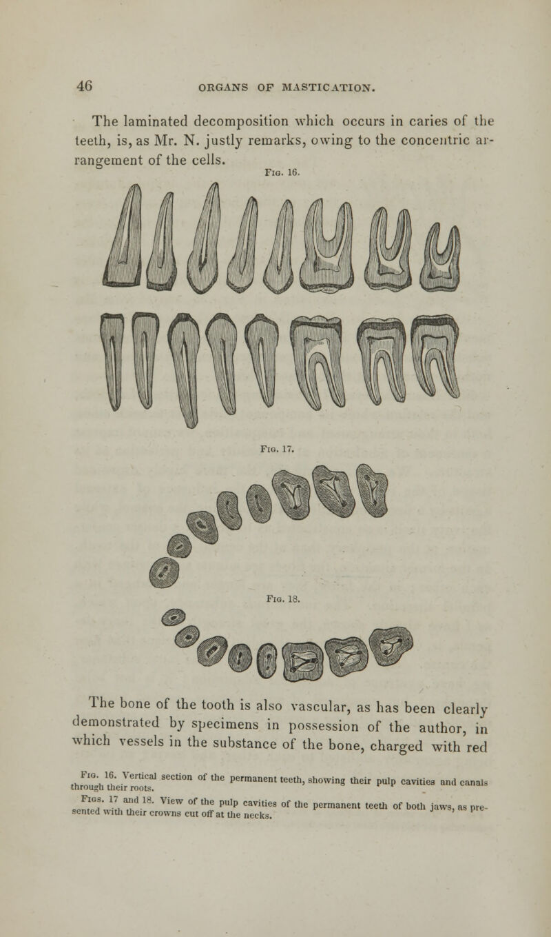 The laminated decomposition which occurs in caries of the teeth, is, as Mr. N. justly remarks, owing to the concentric ar- rangement of the cells. Fio. 16. The bone of the tooth is also vascular, as has been clearly demonstrated by specimens in possession of the author, in which vessels in the substance of the bone, charged with red |J>^ ** m SeCU°n °f thC Permanem teeth' showing their PulP cavitie9 and canal* J^'Jili T 18' ViCW °f the PUlp °avities of the Pc»™nent teeth of both jaws, as pre- sented with their crowns cut off at the necks.