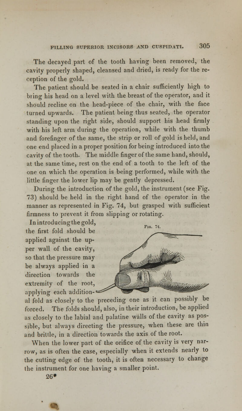 The decayed part of the tooth having been removed, the cavity properly shaped, cleansed and dried, is ready for the re- ception of the gold. The patient should be seated in a chair sufficiently high to bring his head on a level with the breast of the operator, and it should recline on the head-piece of the chair, with the face turned upwards. The patient being thus seated, the operator standing upon the right side, should support his head firmly with his left arm during the operation, while with the thumb and forefinger of the same, the strip or roll of gold is held, and one end placed in a proper position for being introduced into the cavity of the tooth. The middle finger of the same hand, should, at the same time, rest on the end of a tooth to the left of the one on which the operation is being performed, while with the little finger the lower lip may be gently depressed. During the introduction of the gold, the instrument (see Fig. 73) should be held in the right hand of the operator in the manner as represented in Fig. 74, but. grasped with sufficient firmness to prevent it from slipping or rotating. In introducing the gold, & & ' Fig. 74. the first fold should be applied against the up- per wall of the cavity, so that the pressure may be always applied in a direction towards the extremity of the root, ^J|| W^M^MIkii^^k applying each addition- al fold as closely to the preceding one as it can possibly be forced. The folds should, also, in their introduction, be applied as closely to the labial and palatine walls of the cavity as pos- sible, but always directing the pressure, when these are thin and brittle, in a direction towards the axis of the root. When the lower part of the orifice of the cavity is very nar- row, as is often the case, especially when it extends nearly to the cutting edge of the tooth, it is often necessary to change the instrument for one having a smaller point. 26*