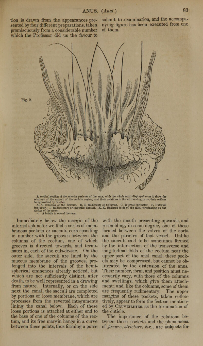 tion is drawn from the appearances pre- sented by four different preparations, taken promiscuously from a considerable number which the Professor did us the favour to submit to examination, and the accompa- nying figure has been executed from one of them. Fig. 2. A vertical section of the anterior parietes of toe anus, with the whole canal displayed so as to show the relations of the sacculi of the middle region, and their relations to the surrounding parts, their orifices being marked by bristles. A, A. Columns of the Rectum. B, B. Rudiments of Columns. C. Internal Sphincter. F. External Sphincter. 1. Rudimentary or imperfect Sacculi. K, K. Radiated folds of the skin, terminating on the surface of the nates. n. A bristle in one of the sacs. Immediately below the margin of the internal sphincter we find a series of mem- branous pockets or sacculi, corresponding in number with the grooves between the columns of the rectum, one of which grooves is directed towards, and termi- nates in, each of the culs-de-sac. On the outer side, the sacculi are lined by the mucous membrane of the grooves, pro- longed into the intervals of the hemi- spherical eminences already noticed, but which are not sufficiently distinct, after death, to be well represented in a drawing from nature. Internally, or on the side next the canal, the sacculi are completed by portions of loose membrane, which are processes from the reverted integuments lining the canal below. Each of these loose portions is attached at either end to the base of one of the columns of the rec- tum, and its free margin hangs in a curve between these points, thus forming a purse with the mouth presenting upwards, and resembling, in some degree, one of those formed between the valves of the aorta and the parietes of that vessel. Unlike the sacculi said to be sometimes formed by the intersection of the transverse and longitudinal folds of the rectum near the upper part of the anal canal, these pock- ets may be compressed, but cannot be ob- literated by the distension of the anus. Their number, form, and position must ne- cessarily vary, with those of the columns and swellings, which give them attach- ment; and, like the columns, some of them are frequently rudimentary. The upper margins of these pockets, taken collec- tively, appear to form the festoon mention- ed by Cruveilhier as the termination of the cuticle. The importance of the relations be- tween these pockets and the phenomena of fissure, stricture, &c, are subjects for