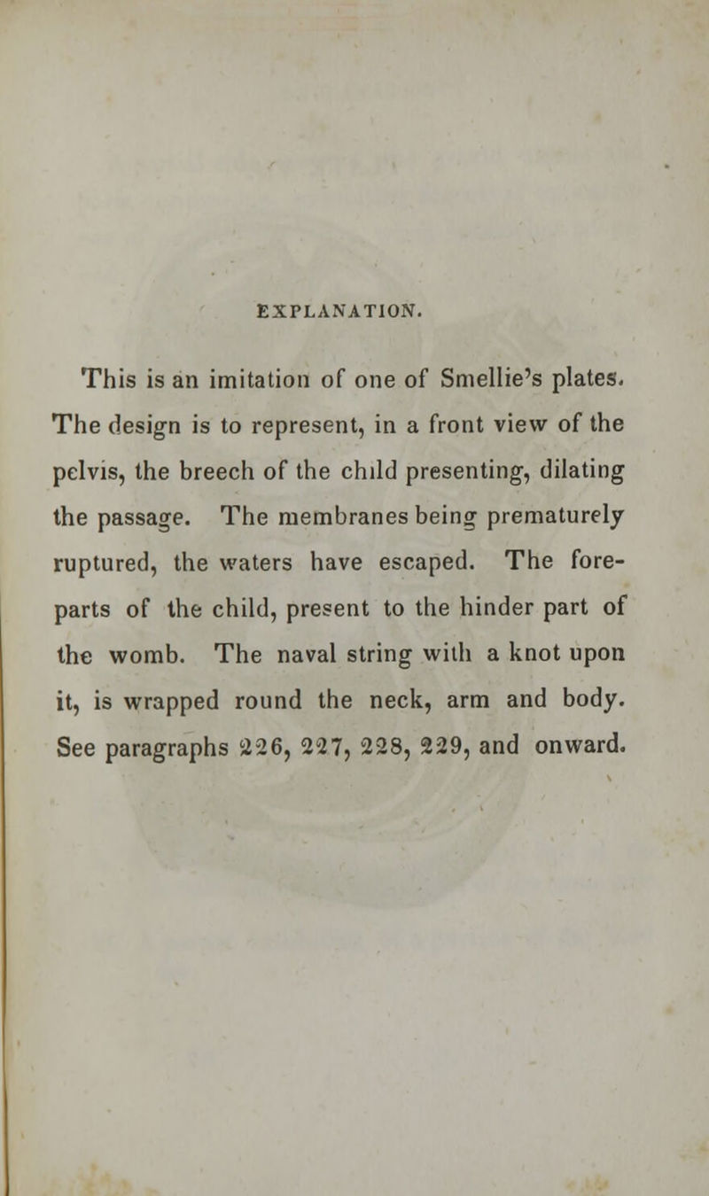 This is an imitation of one of Smellie's plates. The design is to represent, in a front view of the pelvis, the breech of the child presenting, dilating the passage. The membranes being prematurely ruptured, the waters have escaped. The fore- parts of the child, present to the hinder part of the womb. The naval string with a knot upon it, is wrapped round the neck, arm and body. See paragraphs 226, 227, 228, 229, and onward.