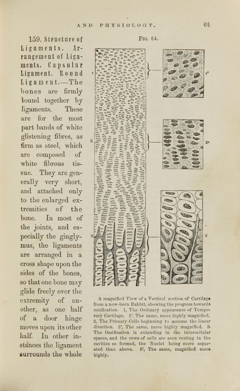 159. Structure of Ligaments. Ar- rangement of Liga- ments. Capsular Ligament. Round Ligam en t.—The bones are firmly tound together by ligaments. These are for the most part bands of white glistening fibres, as firm as steel, which are composed of white fibrous tis- sue. They are gen- erally very short, and attached only to the enlarged ex- tremities of the bone. In most of the joints, and es- pecially the gingly- mus, the ligaments are arranged in a cross shape upon the sides of the bones, so that one bone may glide freely over the extremity of an- other, as one half of a door hinge moves upon its other half. In other in- stances the ligament surrounds the whole Fig. 84. , &.;■ @»v & 9 Hi 4*2 :-7^ ■■.??&■£ &■'■:'■& ■ &>' ['■ ' 5£ esfc '' ta»; «*> -&<®. ,« ;«^» ■<&» '-W°« k» <^a <&'<» <aaw ;t@B % \s» <J*& , fa *> ^SPb «s> ^ Oii? ■ A magnified View of a Vertical section of Cartilag* from a new-born Rabbit, showing the progress towards ossification. 1, The Ordinary appearance of Tempo- rary Cartilage. V. The same, more highly magnified. 2, The Primary Cells beginning to assume the linear direction. 2', The same, more, highly magnified. 3> The Ossification is extending in the intercellular spaces, and the rows of cells are seen resting in the cavities so formed, the Nuclei being more separ- ated thaa above. 3', The same, magnified more highly.