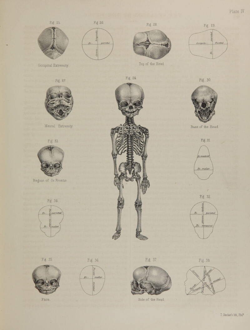 Fig 26 Occipital Extremity Mental Extremity. Fig. 33. Region of Os Frontis. M 34. Fig. 28 Fig 29. Top 01 trie fiead. Fig. 24. Base of the Head. Fig 31. Fig. 32. Fig. 35. Face. Fig 36 Fig. 37. Side of the HecLd. Fig. 38. Sinclair's Ml, Phil1