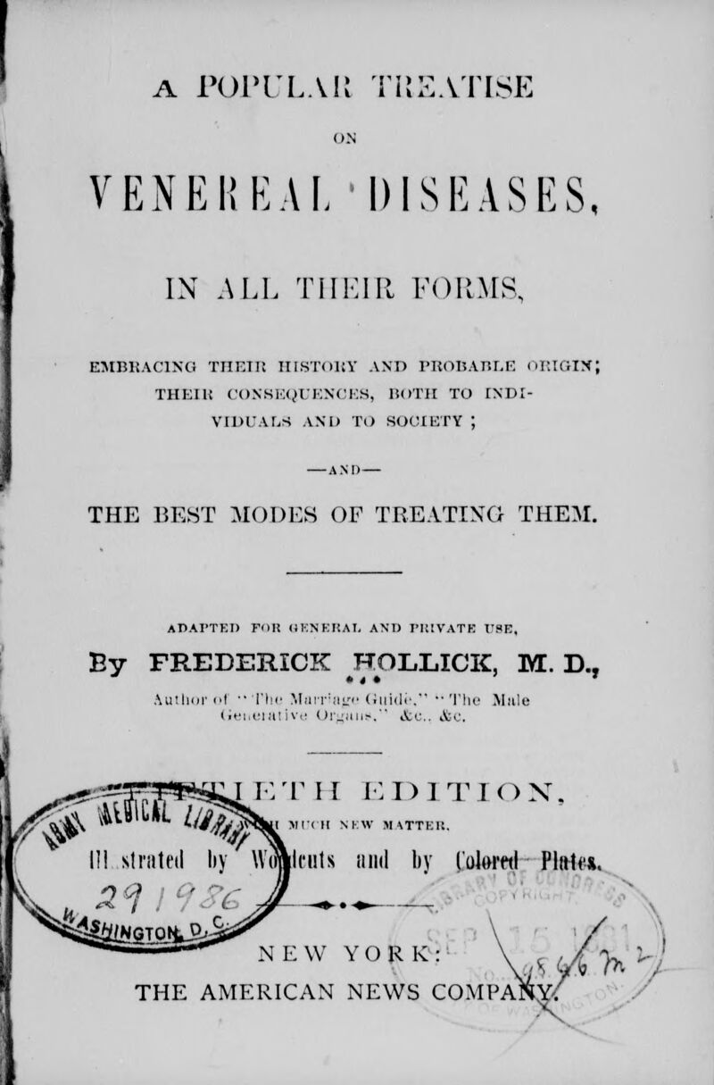 a POPULAR TREATISE VENEREAL DISEASES, IN ALL THEIR FORMS, EMBRACING TTIETl! HISTORY AND PROBABLE ORIGIN; THKIli CONSEQUENCES, BOTH TO ENDI- VIIH'ALS AND TO SOCIETY ', THE BEST MODES OF TREATING THEM. ADAPTED Fon GENERAL ANT) PRIVATE rsB, Ey FREDERICK HOLLICK, 1YE. D., * 4 • * Author oi The Mai-Haye Guide. The Male Geiieiative Orguiic. <fec i&c. iiAcfi, Jjn Wf ETH EDITION, I MUCH NEW MATTER, III slratetl liy Wumli'iits and by I'oloml PliHw. ^4^{NG NEW YORK, \S(A%^