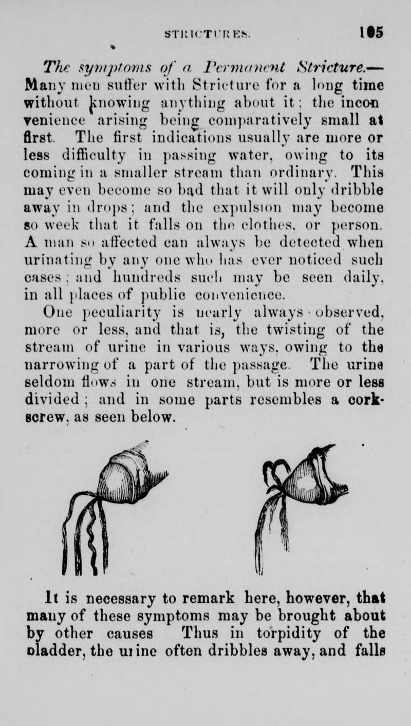 The symptoms of n Permanent Stricture.— Many men Buffer with Stricture for a long time without knowing anything about it: the incon venience arising being comparatively small at first. The first indications usually are more or less difficulty in passing water, owing to its coming in a smaller stream than ordinary. This may even beoome SO had that it will only drihhle away in drops; and the expulsion may become so week that it falls on the clothes, or person. A man so affected can always be detected wdien urinating by any one who lias ever noticed such cases : and hundreds such may be seen daily. in all plaees of public convenience, One peculiarity is nearly always • observed, more or less, and that is, the twisting of the stream of urine in various ways, owing to the narrowing of a part of the passage. The urine seldom Mows in one stream, but is more or less divided ; and in some parts resembles a cork- screw, as seen below. It is necessary to remark here, however, that many of these symptoms may be brought about by other causes Thus in torpidity of the oladder, the uiine often dribbles away, and falls