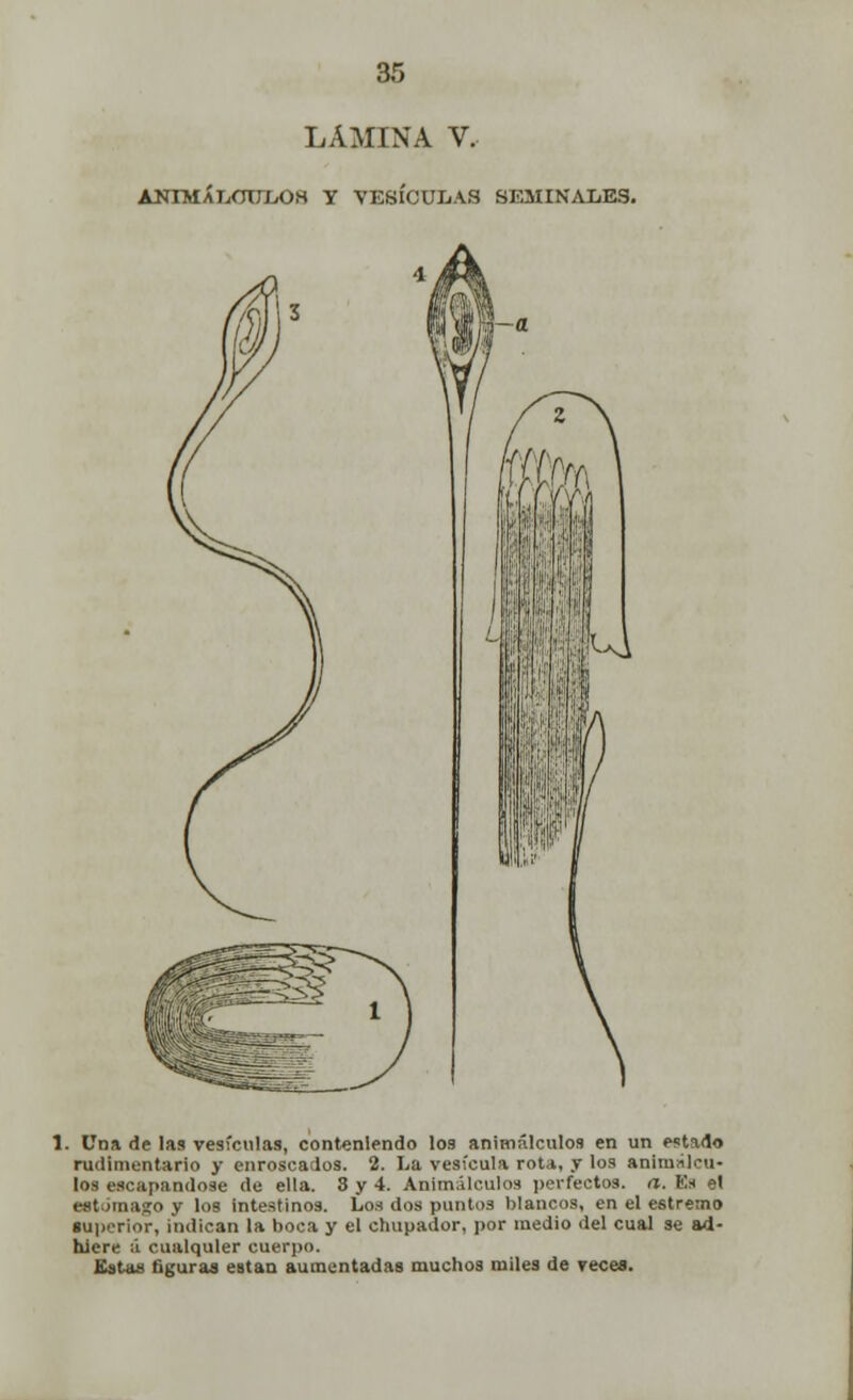 LAMINA V. ANIMÁLCULOS Y VESÍCULAS SEMINALES. . Una de las vesículas, conteniendo los animálculos en un estido rudimentario y enroscados. 2. La vesícula rota, y los animálcu- los escapándose de ella. 8 y 4. Animálculos perfectos, a. V.x el MtómagO y los intestinos. Lo.-¡ dos puntos blancos, en el estretno superior, indican la boca y el chupador, por medio del cual se ad- hiere u cualquier cuerpo. Estas figuras están aumentadas muchos miles de reces.