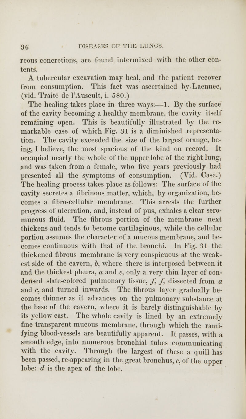 reous concretions, are found intermixed with the other con- tents. A tubercular excavation may heal, and the patient recover from consumption. This fact was ascertained by Laennec, (vid. Traite de l'Auscult, i. 580.) The healing takes place in three ways:—1. By the surface of the cavity becoming a healthy membrane, the cavity itself remaining open. This is beautifully illustrated by the re- markable case of which Fig. 31 is a diminished representa- tion. The cavity exceeded the size of the largest orange, be- ing, I believe, the most spacious of the kind on record. It occupied nearly the whole of the upper lobe of the right lung, and was taken from a female, who five years previously had presented all the symptoms of consumption. (Vid. Case.) The healing process takes place as follows: The surface of the cavity secretes a fibrinous matter, which, by organization, be- comes a fibro-cellular membrane. This arrests the further progress of ulceration, and, instead of pus, exhales a clear sero- mucous fluid. The fibrous portion of the membrane next thickens and tends to become cartilaginous, while the cellular portion assumes the character of a mucous membrane, and be- comes continuous with that of the bronchi. In Fig. 31 the thickened fibrous membrane is very conspicuous at the weak- est side of the cavern, b, where there is interposed between it and the thickest pleura, a and c, only a very thin layer of con- densed slate-colored pulmonary tissue, f, f, dissected from a and c, and turned inwards. The fibrous layer gradually be- comes thinner as it advances on the pulmonary substance at the base of the cavern, where it is barely distinguishable by its yellow cast. The whole cavity is lined by an extremely fine transparent mucous membrane, through which the rami- fying blood-vessels are beautifully apparent. It passes, with a smooth edge, into numerous bronchial tubes communicating with the cavity. Through the largest of these a quill has been passed, re-appearing in the great bronchus, e, of the upper lobe: d is the apex of the lobe.