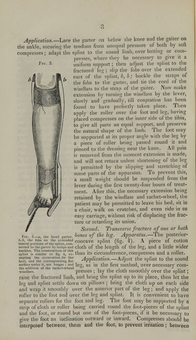 Application.—-Lace the garter on Ijelow the knee and the gaiter on the ankle, securing the tendons from unequal pressure of both by soft compresses; adapt the splint to the sound limb, over batting or com- presses, where they be necessary to give it a uniform support ; then adjust the splint to the fractured leg ; slip the fobs over the extended ears of lhesplint, b, b; buckle the straps of the fobs to the garter, and tie the cord of the windlass to the strap of the gaiter. Now make extension by turning the windlass by the lever, slowly and gradually, till coaptation has been found to have perfectly taken place. Then apply the roller over the foot and leg, having placed compresses on the inner side of the tibia, to give all parts an equal support, and preserve the natural shape of the limb. The foot may be supported at its proper angle with the leg by a piece of roller being passed round it and pinned to the dressing near the knee. All pain is removed from the moment extension is made, and will not return unless shortening of the leg is permitted by the slipping and stretching of some parts of the apparatus. To prevent this, a small weight should be suspended from the lever during the first twenty-four hours of treat- ment. After this, the necessary extension being retained by the windlass and rachet-wheel, the patient may be permitted to leave his bed, sit in a chair, walk on crutches, and even ride in an easy carriage, without risk of displacing the frac- ture or retarding its union. Second. Transverse fracture of one or both bones of the leg. Apparatus.—The posterior- b b, the robs on the emended COncave splint (fig. 4). A piece of cotton lateral portions of the splint, con- r \ o / r nected to thdgarter by straps and cloth of the length of the leg, and a little wider buckles. The construction of this \ •. ■ r j n splint is similar to n^ 4, ev-than its circumference, com presses and a roller, ff aVthe ™Sd!i Z Application.-M^t the splint to the sound surface under it, are longer; and W as in the first method, over necessary corn- the addition of the rachet-wheel ° , , , . . . ■ *■ windlass. presses ; lay the cloth smoothly over the splint; raise the fractured limb, and bring the splint up to its place, then let the leg and splint settle down on pillows ; bring the cloth up on each side and wrap it smoothly over the anterior part of the leg; and apply the roller to the foot and over the leg and splint. It is convenient to have separate rollers for the foot and leg. The foot may be supported by a strip of cloth or roller being carried round the foot-pieces of the splint and the foot, or round but one of the foot-pieces, if it be necessary to give the foot an inclination outward or inward. Compresses should be interposed between them and the foot, to prevent irritation; between Fig. 3.—a, the laced garter.