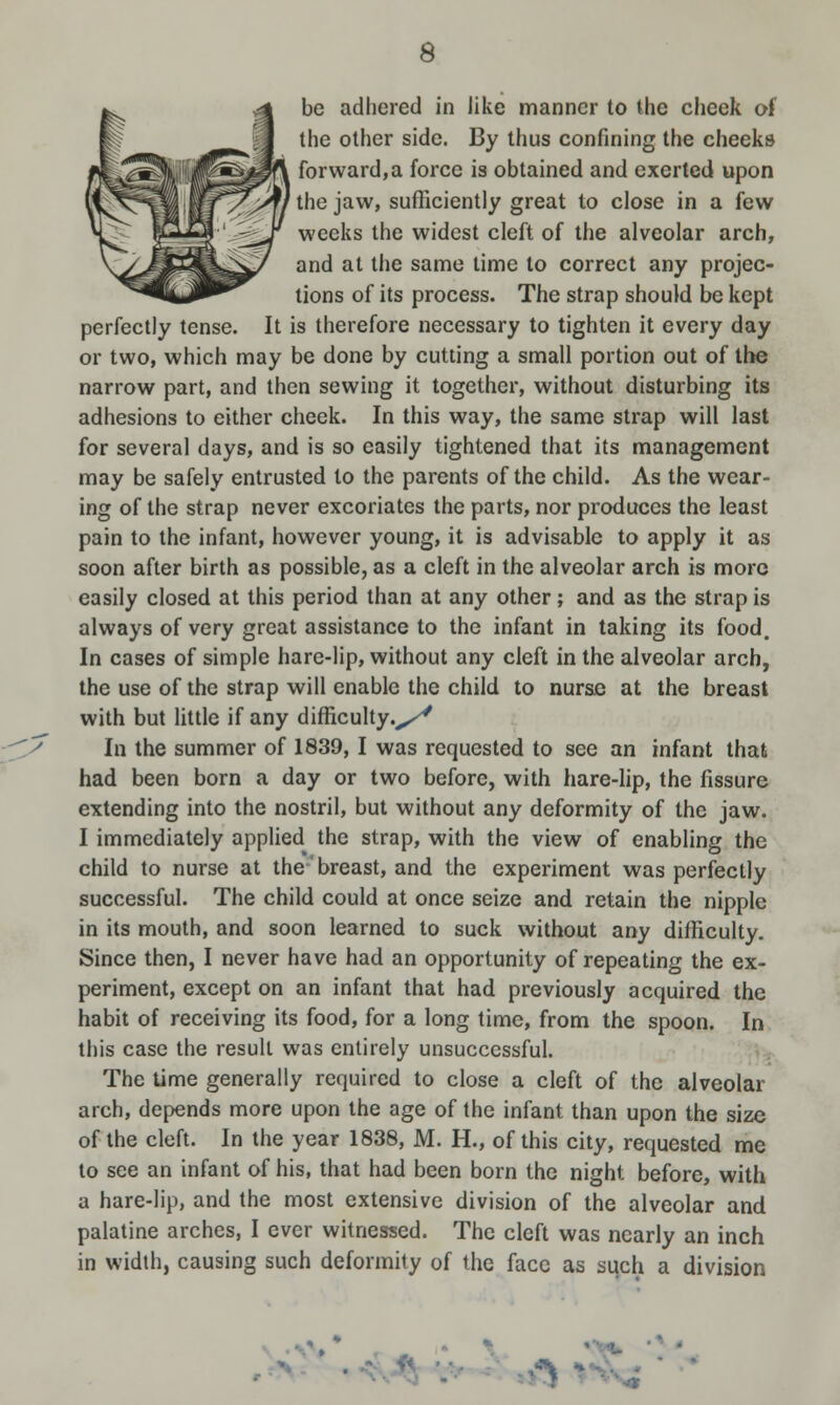 be adhered in like manner to the cheek of the other side. By thus confining the cheeks forward,a force is obtained and exerted upon the jaw, sufficiently great to close in a few weeks the widest cleft of the alveolar arch, and at the same time to correct any projec- tions of its process. The strap should be kept perfectly tense. It is therefore necessary to tighten it every day or two, which may be done by cutting a small portion out of the narrow part, and then sewing it together, without disturbing its adhesions to either cheek. In this way, the same strap will last for several days, and is so easily tightened that its management may be safely entrusted to the parents of the child. As the wear- ing of the strap never excoriates the parts, nor produces the least pain to the infant, however young, it is advisable to apply it as soon after birth as possible, as a cleft in the alveolar arch is more easily closed at this period than at any other; and as the strap is always of very great assistance to the infant in taking its food. In cases of simple hare-lip, without any cleft in the alveolar arch, the use of the strap will enable the child to nurse at the breast with but little if any difficulty.,^ In the summer of 1839, I was requested to see an infant that had been born a day or two before, with hare-lip, the fissure extending into the nostril, but without any deformity of the jaw. I immediately applied the strap, with the view of enabling the child to nurse at the breast, and the experiment was perfectly successful. The child could at once seize and retain the nipple in its mouth, and soon learned to suck without any difficulty. Since then, I never have had an opportunity of repeating the ex- periment, except on an infant that had previously acquired the habit of receiving its food, for a long time, from the spoon. In this case the result was entirely unsuccessful. The time generally required to close a cleft of the alveolar arch, depends more upon the age of the infant than upon the size of the cleft. In the year 1838, M. H., of this city, requested me to see an infant of his, that had been born the night before, with a hare-lip, and the most extensive division of the alveolar and palatine arches, I ever witnessed. The cleft was nearly an inch in width, causing such deformity of the face as such a division