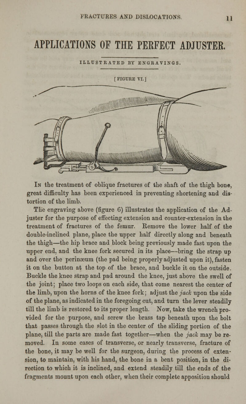 APPLICATIONS OF THE PERFECT ADJUSTER. ILLUSTRATED BY ENGRAVINGS. [FIGURE VI.] In the treatment of oblique fractures of the shaft of the thigh bone, great difficulty has been experienced in preventing shortening and dis- tortion of the limb. The engraving above (figure G) illustrates the application of the Ad- juster for the purpose of effecting extension and counter-extension in the treatment of fractures of the femur. Remove the lower half of the double-inclined plane, place the upper half directly along and beneath the thigh—the hip brace and block being previously made fast upon the upper end, and the knee fork secured in its place—bring the strap up and over the perinaeum (the pad being properly adjusted upon it), fasten it on the button at the top of the brace, and buckle it on the outside. Buckle the knee strap and pad around the knee, just above the swell of the joint; place two loops on each side, that come nearest the center of the limb, upon the horns of the knee fork; adjust the jack upon the side of the plane, as indicated in the foregoing cut, and turn the lever steadily till the limb is restored to its proper length. Now, take the wrench pro- vided for the purpose, and screw the brass tap beneath upon the bolt that passes through the slot in the center of the sliding portion of the plane, till the parts are made fast together—when the jack may be re- moved. In some cases of transverse, or nearly transverse, fracture of the bone, it may be well for the surgeon, during the process of exten- sion, to maintain, with his hand, the bone in a bent position, in the di- rection to which it is inclined, and extend steadily till the ends of the fragments mount upon each other, when their complete apposition should