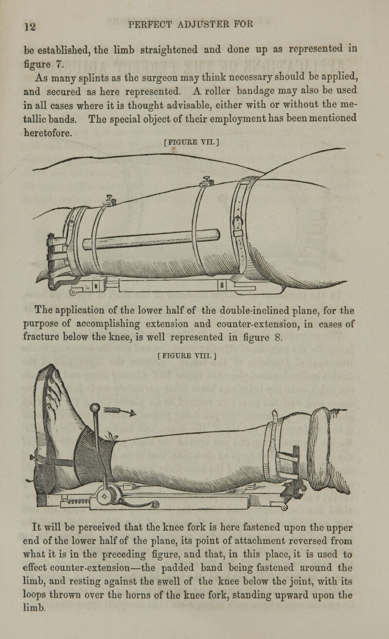 be established, the limb straightened and done up as represented in figure 7. As many splints as the surgeon may think necessary should be applied, and secured as here represented. A roller bandage may also be used in all cases where it is thought advisable, either with or without the me- tallic bands. The special object of their employment has been mentioned heretofore. [FIGURE TIL] The application of the lower half of the double-inclined plane, for the purpose of accomplishing extension and counter-extension, in cases of fracture below the knee, is well represented in figure 8. [FIGURE VIII.] It will be perceived that the knee fork is here fastened upon the upper end of the lower half of the plane, its point of attachment reversed from what it is in the preceding figure, and that, in this place, it is used to effect counter-extension—the padded band being fastened around the limb, and resting against the swell of the knee below the joint, with its loops thrown over the horns of the knee fork, standing upward upon the limb.