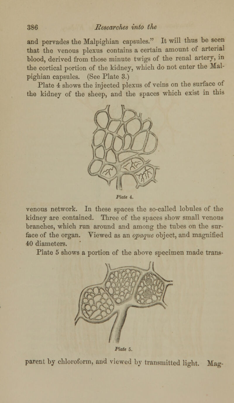 and pervades the Malpigliian capsules. It will thus be seen that the venous plexus contains a certain amount of arterial blood, derived from those minute twigs of the renal artery, in the cortical portion of the kidney, which do not enter the Mal- pighian capsules. (See Plate 3.) Plate 4 shows the injected plexus of veins on the surface of the kidney of the sheep, and the spaces which exist in this Plate 4. venous network. In these spaces the so-called lobules of the kidney are contained. Three of the spaces show small venous branches, which run around and among the tubes on the sur- face of the organ. Viewed as an opaque object, and magnified 40 diameters. Plate 5 shows a portion of the above specimen made trans- Plate 5. parent by chloroform, and viewed by transmitted light Mag-