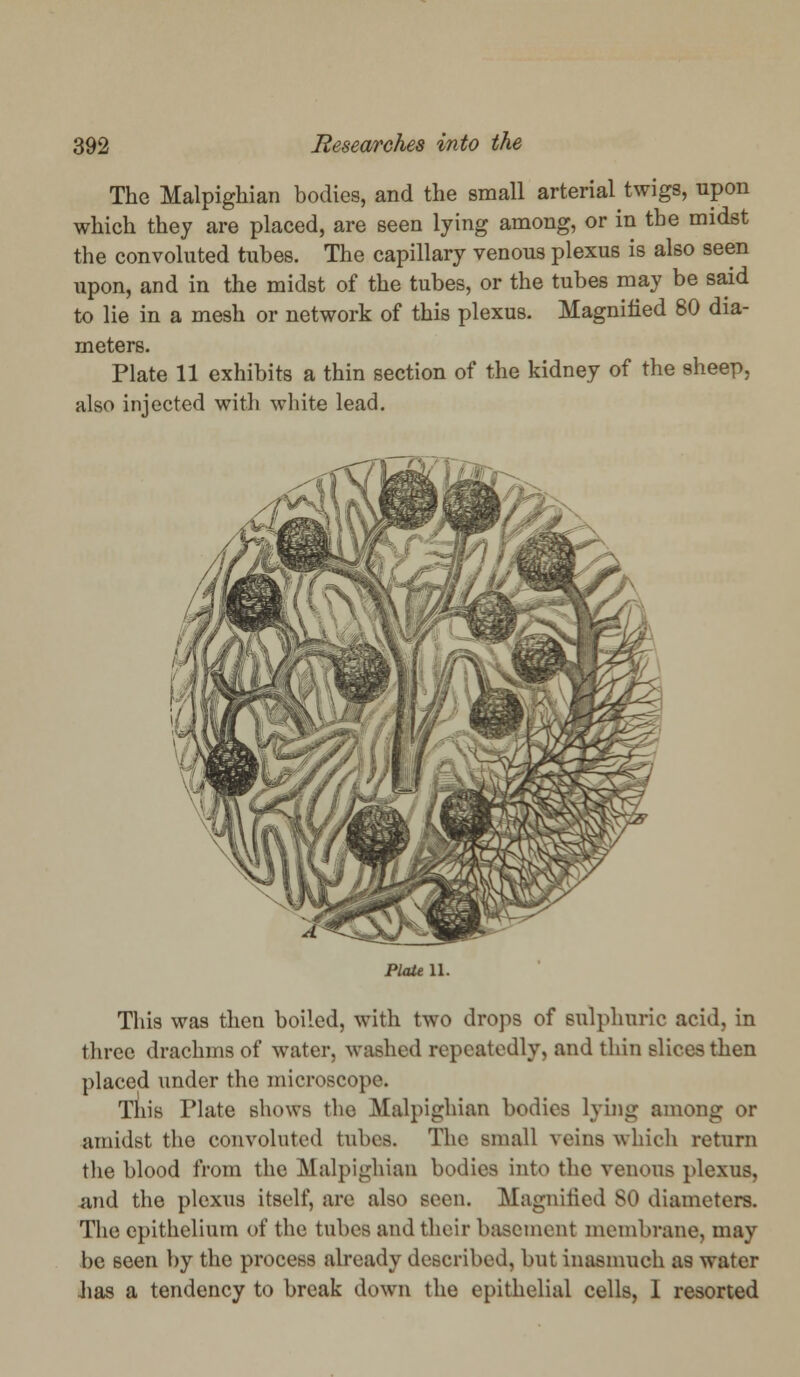 The Malpighian bodies, and the small arterial twigs, upon which they are placed, are seen lying among, or in the midst the convoluted tubes. The capillary venous plexus is also seen upon, and in the midst of the tubes, or the tubes may be said to lie in a mesh or network of this plexus. Magnified 80 dia- meters. Plate 11 exhibits a thin section of the kidney of the sheep, also injected with white lead. Plate n. This was then boiled, with two drops of sulphuric acid, in three drachms of water, washed repeatedly, and thin slices then placed under the microscope. This Plate shows the Malpighian bodies lying among or amidst the convoluted tubes. The small veins which return the blood from the Malpighian bodies into the venous plexus, and the plexus itself, are also seen. Magnified 80 diameters. The epithelium of the tubes and their basement membrane, may be seen by the process already described, but inasmuch as water lias a tendency to break down the epithelial cells, I resorted