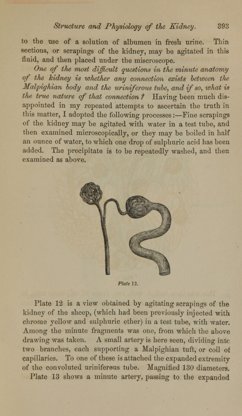 to the use of a solution of albumen in fresh urine. Thin sections, or scrapings of the kidney, may be agitated in thi6 fluid, and then placed under the miscroscope. One of the most difficult questions in the minute anatomy of the kidney is whether any connection exists between the Malpighian body and the uriniferous tube, and if so, what is the true nature of that connection ? Having been much dis- appointed in my repeated attempts to ascertain the truth in this matter, I adopted the following processes:—Fine scrapings of the kidney may be agitated with water in a test tube, and then examined microscopically, or they may be boiled in half an ounce of water, to which one drop of sulphuric acid has been added. The precipitate is to be repeatedly washed, and then examined as above. Plate 12. Plate 12 is a view obtained by agitating scrapings of the kidney of the sheep, (which had been previously injected with chrome yellow and sulphuric ether) in a test tube, with water. Among the minute fragments was one, from which the above drawing was taken. A small artery is here seen, dividing intc two branches, each supporting a Malpighian tuft, or coil of capillaries. To one of these is attached the expanded extremity of the convoluted uriniferous tube. Magnified 130 diameters. Plate 13 shows a minute artery, passing to the expanded