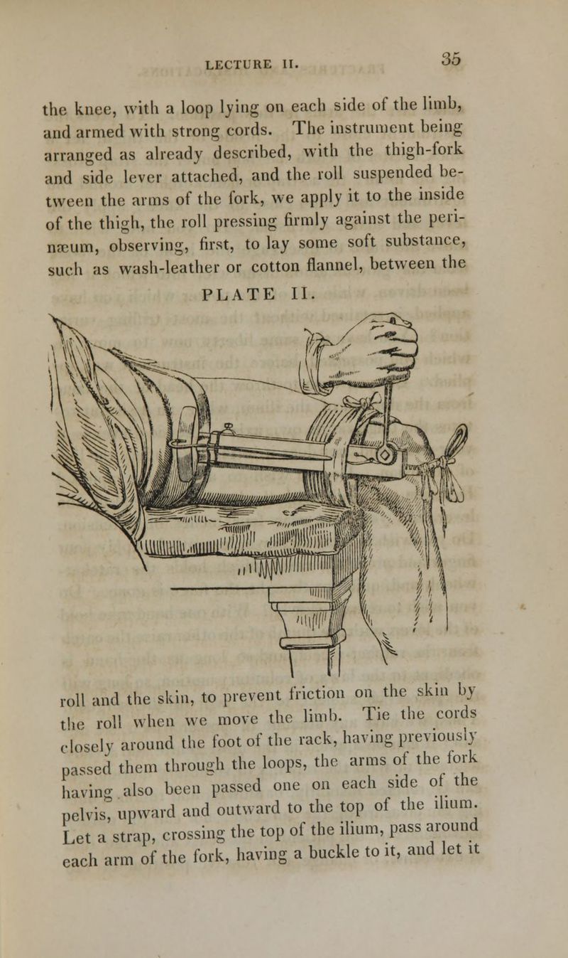 the knee, with a loop lying on each side of the limb, and armed with strong cords. The instrument being arranged as already described, with the thigh-fork and side lever attached, and the roll suspended be- tween the arms of the fork, we apply it to the inside of the thigh, the roll pressing firmly against the peri- neum, observing, first, to lay some soft substance, such as wash-leather or cotton flannel, between the PLATE II. roll and the skin, to prevent friction on the skm by the roll when we move the limb. Tie the cords closely around the foot of the rack, having previously passed them through the loops, the arms ol the fork having also been passed one on each side of the pelvis^ upward and outward to the top of the ilium. Let a strap, crossing the top of the ilium, pass around each arm of the fork, having a buckle to it, and let it