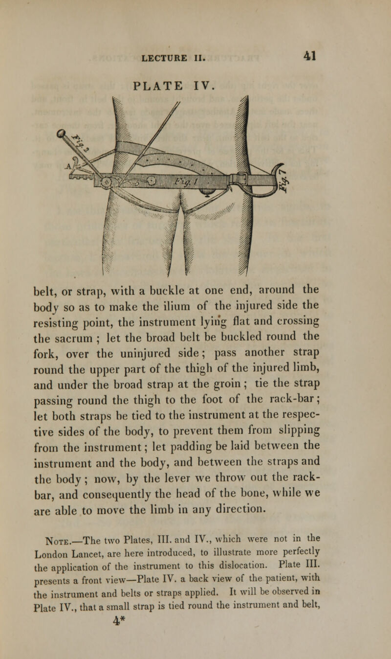 PLATE IV 41 belt, or strap, with a buckle at one end, around the body so as to make the ilium of the injured side the resisting point, the instrument lying flat and crossing the sacrum ; let the broad belt be buckled round the fork, over the uninjured side; pass another strap round the upper part of the thigh of the injured limb, and under the broad strap at the groin; tie the strap passing round the thigh to the foot of the rack-bar ; let both straps be tied to the instrument at the respec- tive sides of the body, to prevent them from slipping from the instrument; let padding be laid between the instrument and the body, and between the straps and the body; now, by the lever we throw out the rack- bar, and consequently the head of the bone, while we are able to move the limb in any direction. N0TE.—The two Plates, III. and IV., which were not in the London Lancet, are here introduced, to illustrate more perfectly the application of the instrument to this dislocation. Plate III. presents a front view—Plate IV. a back view of the patient, with the instrument and belts or straps applied. It will be observed in Plate IV., that a small strap is tied round the instrument and belt, 4*