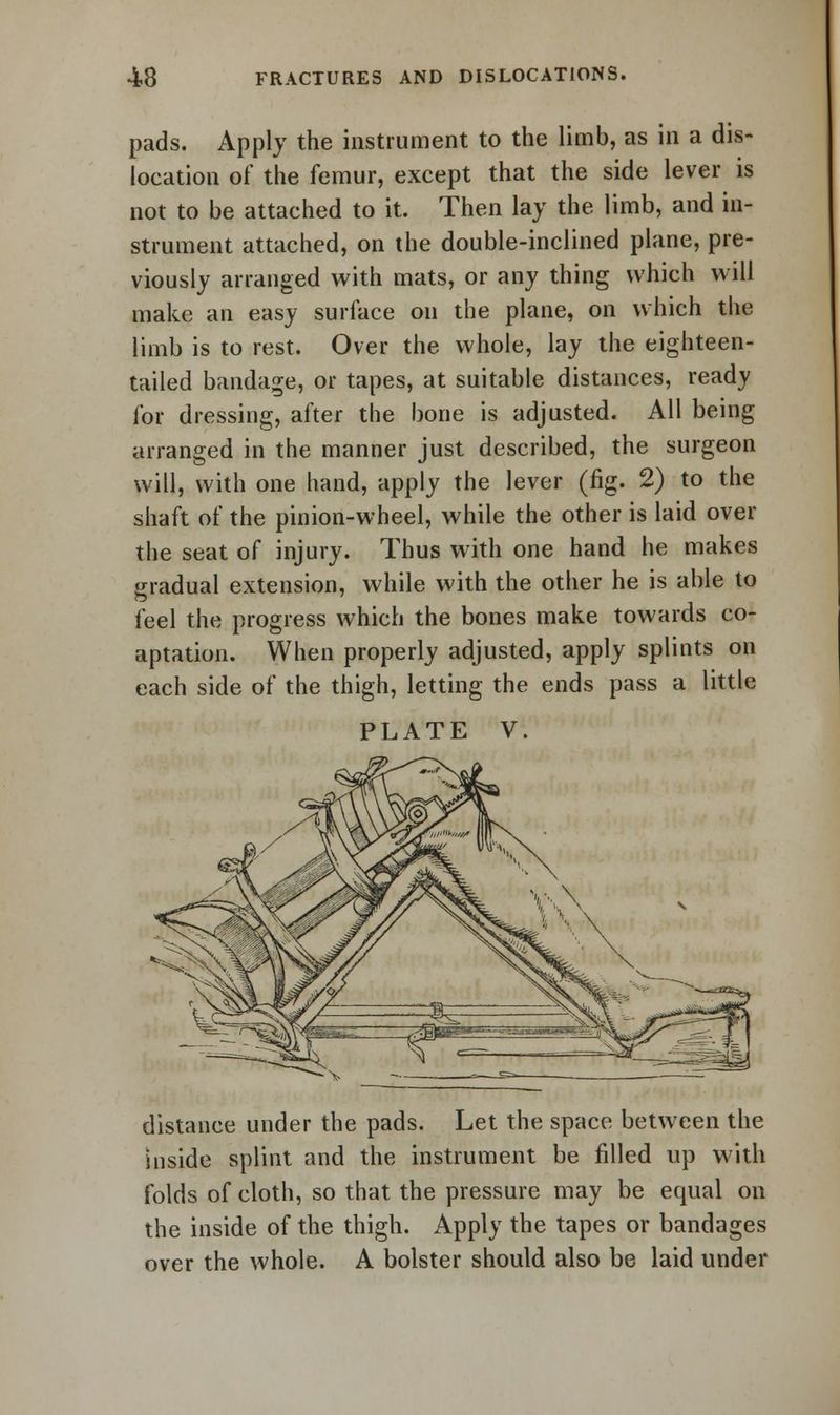pads. Apply the instrument to the limb, as in a dis- location of the femur, except that the side lever is not to be attached to it. Then lay the limb, and in- strument attached, on the double-inclined plane, pre- viously arranged with mats, or any thing which will make an easy surface on the plane, on which the limb is to rest. Over the whole, lay the eighteen- tailed bandage, or tapes, at suitable distances, ready for dressing, after the bone is adjusted. All being arranged in the manner just described, the surgeon will, with one hand, apply the lever (fig. 2) to the shaft of the pinion-wheel, while the other is laid over the seat of injury. Thus with one hand he makes gradual extension, while with the other he is able to feel the progress which the bones make towards co- aptation. When properly adjusted, apply splints on each side of the thigh, letting the ends pass a little PLATE V. distance under the pads. Let the space between the Inside splint and the instrument be filled up with folds of cloth, so that the pressure may be ecpial on the inside of the thigh. Apply the tapes or bandages over the whole. A bolster should also be laid under