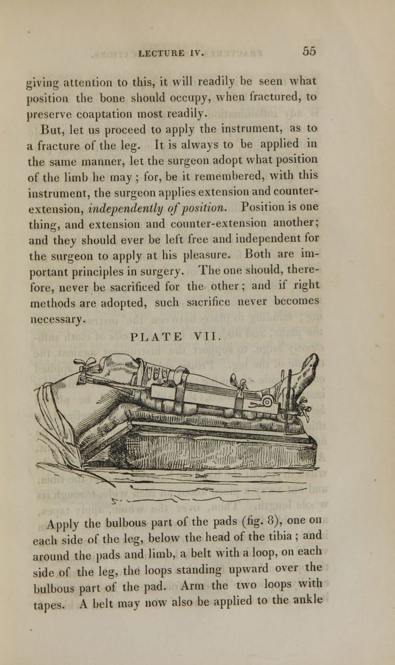 giving .attention to this, it will readily be seen what position the bone should occupy, when fractured, to preserve coaptation most readily. But, let us proceed to apply the instrument, as to a fracture of the leg. It is always to be applied in the same manner, let the surgeon adopt what position of the limb he may ; for, be it remembered, with this instrument, the surgeon applies extension and counter- extension, independently of position. Position is one thing, and extension and counter-extension another; and they should ever be left free and independent for the surgeon to apply at his pleasure. Both are im- portant principles in surgery. The one should, there- fore, never be sacrificed for the other; and if right methods are adopted, such sacrifice never becomes necessary. PLATE VII. Apply the bulbous part of the pads (fig. 8), one on each side of the leg, below the head of the tibia ; and around the pads and limb, a belt with a loop, on each side of the leg, the loops standing upward over the bulbous part of the pad. Arm the two loops with tapes. A belt may now also be applied to the ankle