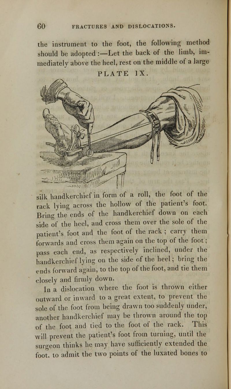the instrument to the foot, the following method should be adopted :—Let the back of the limb, im- mediately above the heel, rest on the middle of a large PLATE IX. snM\| Mi|i) silk handkerchief in form of a roll, the foot of the rack lying across the hollow of the patient's foot. Bring the ends of the handkerchief down on each side of the heel, and cross them over the sole of the patient's foot and the foot of the rack ; carry them forwards and cross them again on the top of the foot; pass each end, as respectively inclined, under the handkerchief lying on the side of the heel; bring the ?nds forward again, to the top of the foot, and tie them closely and firmly down. In a dislocation where the foot is thrown either outward or inward to a great extent, to prevent the sole of the foot from being drawn too suddenly under, another handkerchief may be thrown around the top of the foot and tied to the foot of the rack. This will prevent the patient's foot from turning, until the surgeon thinks he may have sufficiently extended the foot, to admit the two points of the luxated bones to