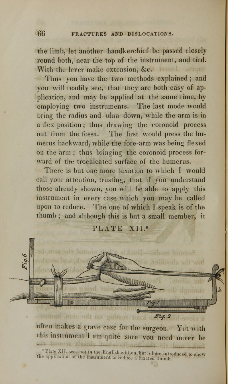 the limb, let another handkerchief be passed closely round both, near the top of the instrument, and tied. With the lever make extension, &c. Thus you have the two methods explained ; and you will readily see, that they are both easy of ap- plication, and may be applied at the same time, by employing two instruments. The last mode would bring the radius and ulna down, while the arm is in a flex position; thus drawing the coronoid process out from the fossa. The first would press the hu- merus backward, while the fore-arm was being flexed on the arm ; thus bringing the coronoid process for- ward of the trochleated surface of the humerus. There is but one more luxation to which I would call your attention, trusting, that if you understand those already shown, you will be able to apply this instrument in every case which you may be called upon to reduce. The one of which I speak is of the thumb ; and although this is but a small member, it PLATE XII* Fitf.2 often makes a grave case for the surgeon. Yet with iftis instrument I am quite sure vou need never be - Plate XII, was not in the English edition, hut is here introduced to show Ifle application of the instrument to reduce a luxated thumb.