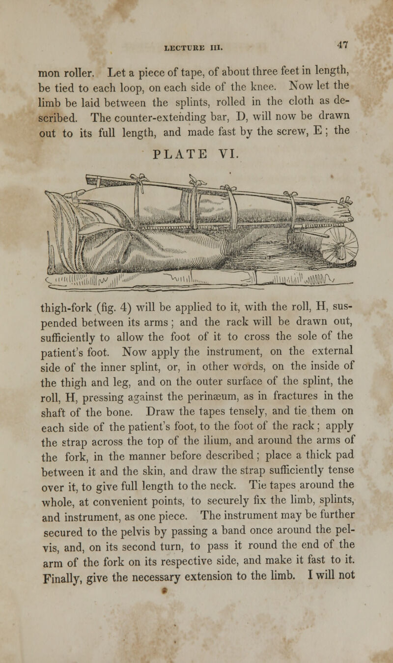 mon roller. Let a piece of tape, of about three feet in length, be tied to each loop, on each side of the knee. Now let the limb be laid between the splints, rolled in the cloth as de- scribed. The counter-extending bar, D, will now be drawn out to its full length, and made fast by the screw, E; the PLATE VI. thigh-fork (fig. 4) will be applied to it, with the roll, H, sus- pended between its arms ; and the rack will be drawn out, sufficiently to allow the foot of it to cross the sole of the patient's foot. Now apply the instrument, on the external side of the inner splint, or, in other words, on the inside of the thigh and leg, and on the outer surface of the splint, the roll, H, pressing against the perinseum, as in fractures in the shaft of the bone. Draw the tapes tensely, and tie them on each side of the patient's foot, to the foot of the rack ; apply the strap across the top of the ilium, and around the arms of the fork, in the manner before described ; place a thick pad between it and the skin, and draw the strap sufficiently tense over it, to give full length to the neck. Tie tapes around the whole, at convenient points, to securely fix the limb, splints, and instrument, as one piece. The instrument may be further secured to the pelvis by passing a band once around the pel- vis, and, on its second turn, to pass it round the end of the arm of the fork on its respective side, and make it fast to it. Finally, give the necessary extension to the limb. I will not