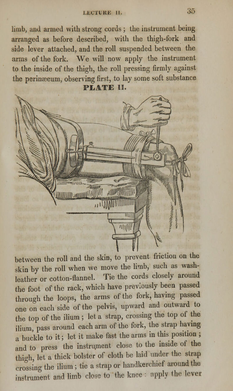 limb, and armed with strong cords ; the instrument being arranged as before described, with the thigh-fork and side lever attached, and the roll suspended between the arms of the fork. We will now apply the instrument to the inside of the thigh, the roll pressing firmly against the perinseeum, observing first, to lay some soft substance PIRATE II. between the roll and the skin, to prevent friction on the skin by the roll when we move the limb, such as wash- leather or cotton-flannel. Tie the cords closely around the foot of the rack, which have previously been passed through the loops, the arms of the fork, having passed one on each side of the pelvis, upward and outward to the top of the ilium ; let a strap, crossing the top of the ilium, pass around each arm of the fork, the strap having a buckle to it; let it make fast the arms in this position ; and to press the instrument close to the inside of the thigh, let a thick bolster of cloth be laid under the strap crossing the ilium; tie a strap or handkerchief around the instrument and limb close to the knee : npply the lever