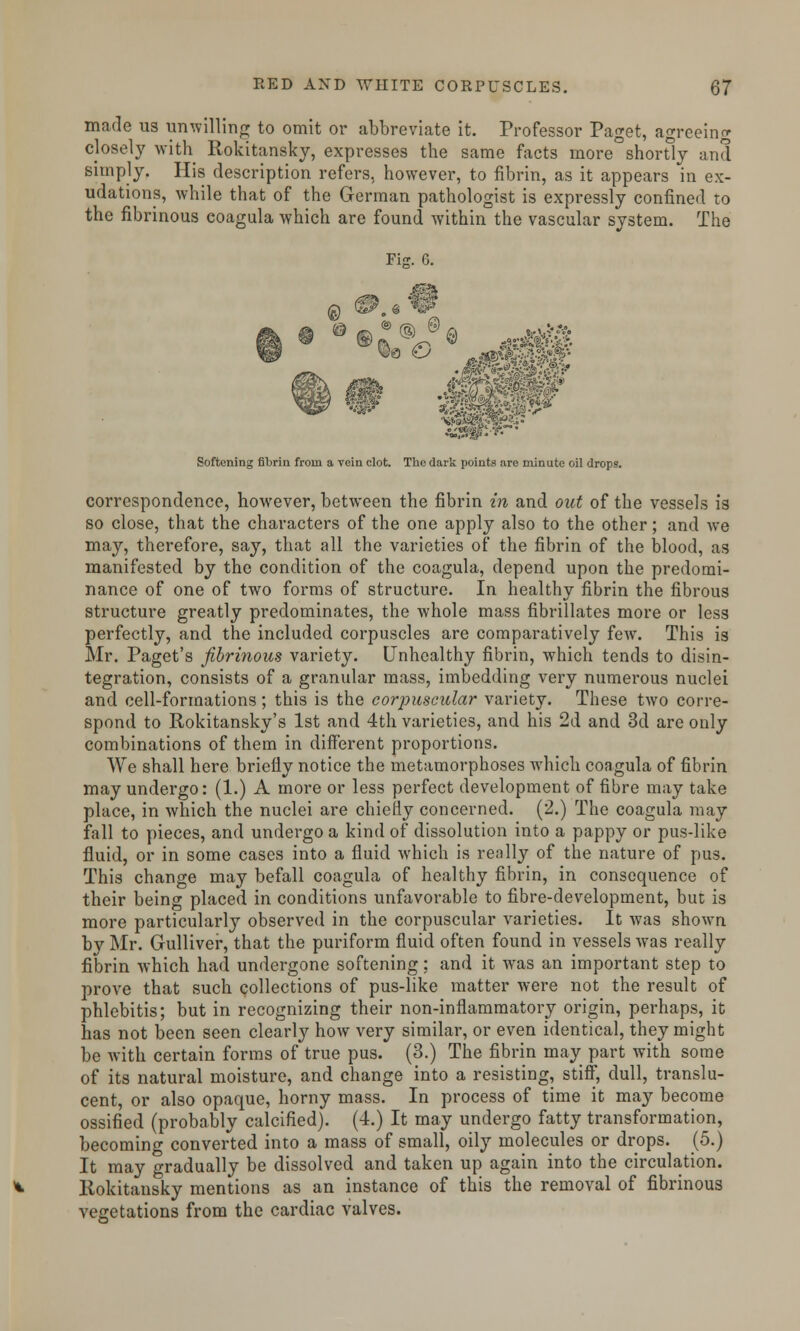 made us unwilling to omit or abbreviate it. Professor Paget, agreeing closely with Rokitansky, expresses the same facts more shortly and simply. His description refers, however, to fibrin, as it appears in ex- udations, while that of the German pathologist is expressly confined to the fibrinous eoagula which are found within the vascular system. The Fitc. 6. Softening fibrin from a rein clot. The dark points are minute oil drops. correspondence, however, between the fibrin in and out of the vessels is so close, that the characters of the one apply also to the other; and we may, therefore, say, that all the varieties of the fibrin of the blood, as manifested by the condition of the eoagula, depend upon the predomi- nance of one of two forms of structure. In healthy fibrin the fibrous structure greatly predominates, the whole mass fibrillates more or less perfectly, and the included corpuscles are comparatively few. This is Mr. Paget's fibrinous variety. Unhealthy fibrin, which tends to disin- tegration, consists of a granular mass, imbedding very numerous nuclei and cell-formations; this is the corpuscular variety. These two corre- spond to Rokitansky's 1st and 4th varieties, and his 2d and 3d are only combinations of them in different proportions. We shall here briefly notice the metamorphoses which eoagula of fibrin may undergo: (1.) A more or less perfect development of fibre may take place, in which the nuclei are chiefly concerned. (2.) The eoagula may fall to pieces, and undergo a kind of dissolution into a pappy or pus-like fluid, or in some cases into a fluid which is really of the nature of pus. This change may befall eoagula of healthy fibrin, in consequence of their being placed in conditions unfavorable to fibre-development, but is more particularly observed in the corpuscular varieties. It was shown by Mr. Gulliver, that the puriform fluid often found in vessels was really fibrin which had undergone softening; and it was an important step to prove that such collections of pus-like matter were not the result of phlebitis; but in recognizing their non-inflammatory origin, perhaps, it has not been seen clearly how very similar, or even identical, they might be with certain forms of true pus. (3.) The fibrin may part with some of its natural moisture, and change into a resisting, stiff, dull, translu- cent, or also opaque, horny mass. In process of time it may become ossified (probably calcified). (4.) It may undergo fatty transformation, becoming converted into a mass of small, oily molecules or drops. (5.) It may gradually be dissolved and taken up again into the circulation. Rokitansky mentions as an instance of this the removal of fibrinous vegetations from the cardiac valves.