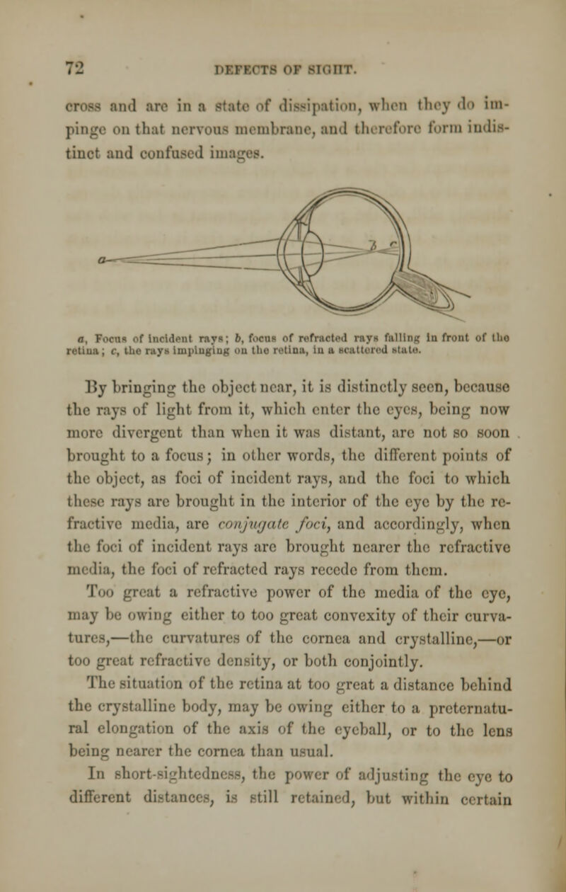 7*2 DOTOH Of IXOBT. and are in a state of dissipation, when they do Im- pinge on thai nervous membrane, and therefore form india- tinct and confused imas a, Focn* of Incident rays; 6, f.»cu< of rsftutod rays falling in front of tlio ntlm; c, the ray« implugiu^ on the retina, In a Mattered state. l>y bringing the object near, it is distinctly seen, D6C the rays of light from it, which enter the eyes, being now more divergent than when it was distant, are not SO SOOU brought to a focus; in other words, the different points of the object, as foci of incident rays, and the foci to which these rays are brought in the; interior of the eye by the re- fractive media, are conjugate foci, and accordingly, when the foci (if incident rays are brought nearer the refractive media, the foci of refracted rays recede from them. Too great a refractive power of the media of the eye, may he owing either to too great convexity of their curva- tures,—the curvatures of the cornea and crystalline,—or too great refractive density, or both conjointly. The situation of the retina at too great a distance behind the crystalline body, may he owing either to a preternatu- ral elongation of the axis of the eyeball, or to the lens being nearer the cornea than usual. In Bhort-BightedneM, tin; power of adjusting the eye to different distances, is still retained, but within certain