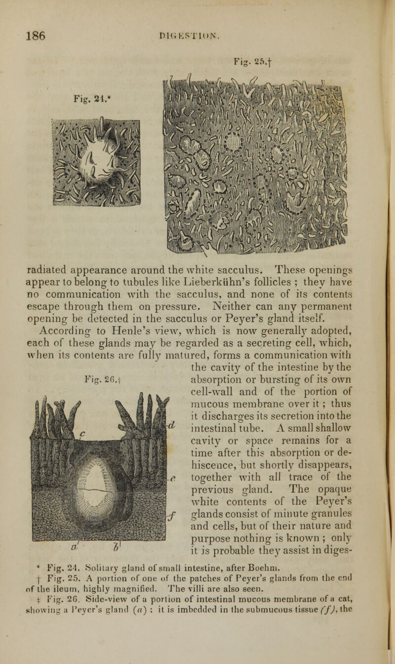 Fig. 25.f Fig. 24 radiated appearance around the white sacculus. These openings appear to belong to tubules like Lieberkiihn's follicles ; they have no communication with the sacculus, and none of its contents escape through them on pressure. Neither can any permanent opening be detected in the sacculus or Peyer's gland itself. According to Henle's view, which is now generally adopted, each of these glands may be regarded as a secreting cell, which, when its contents are fully matured, forms a communication with the cavity of the intestine by the Fig. 2(3.\ absorption or bursting of its own cell-wall and of the portion of mucous membrane over it; thus it discharges its secretion into the intestinal tube. A small shallow cavity or space remains for a time after this absorption or de- hiscence, but shortly disappears, together with all trace of the previous gland. The opaque white contents of the Peyer's glands consist of minute granules and cells, but of their nature and purpose nothing is known ; only it is probable they assist in diges- * Fig. 24. Solitary gland of small intestine, after Boehni. I Fig. 25. A portion of one of the patches of Peyer's glands from the end of the ileum, highly magnified. The villi are also seen. + Fig. 2G. Side-view of a portion of intestinal mucous membrane of a cat, showing a I'eyer's gland («) : it is imbedded in the submucous tissue f/J, the