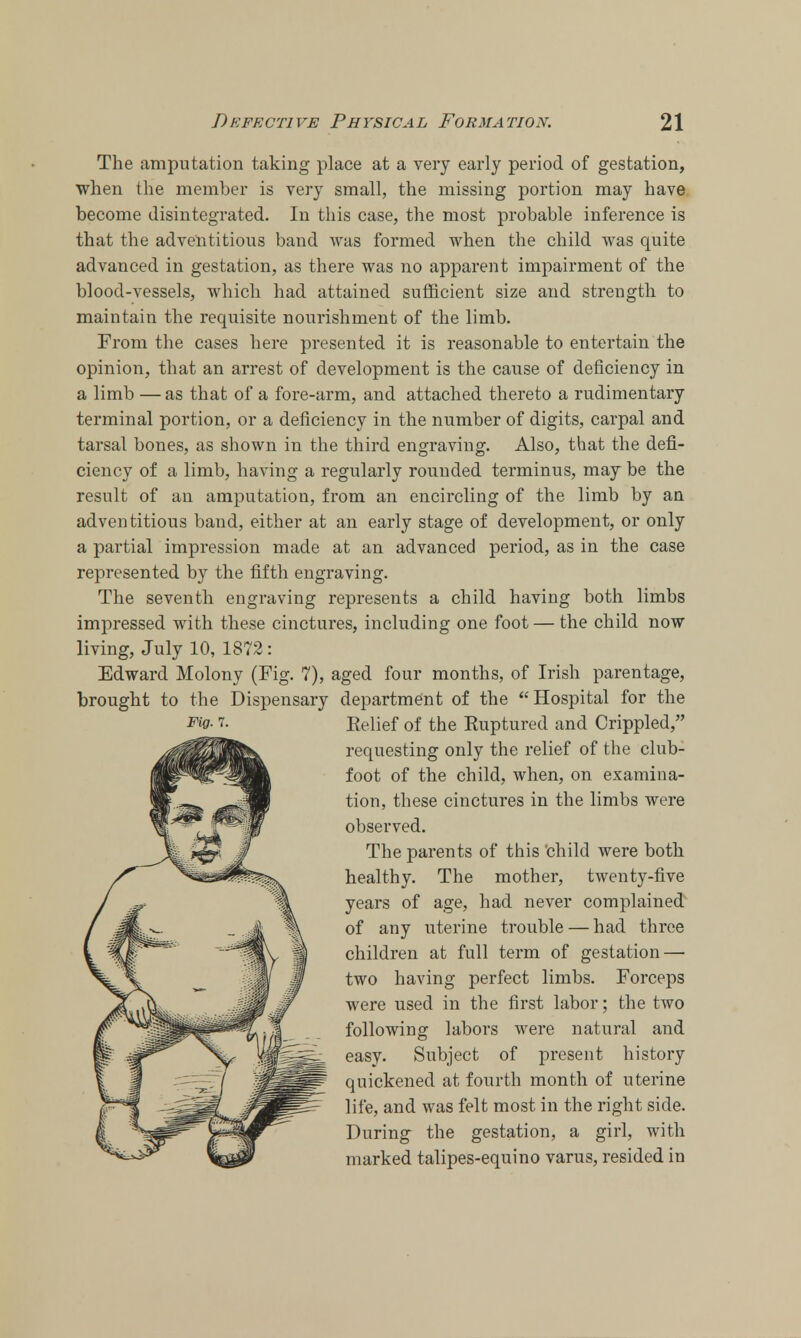 The amputation taking place at a very early period of gestation, when the member is very small, the missing portion may have become disintegrated. In this case, the most probable inference is that the adventitious band was formed when the child was quite advanced in gestation, as there was no apparent impairment of the blood-vessels, which had attained sufficient size and strength to maintain the requisite nourishment of the limb. From the cases here presented it is reasonable to entertain the opinion, that an arrest of development is the cause of deficiency in a limb — as that of a fore-arm, and attached thereto a rudimentary terminal portion, or a deficiency in the number of digits, carpal and tarsal bones, as shown in the third engraving. Also, that the defi- ciency of a limb, having a regularly rounded terminus, may be the result of an amputation, from an encircling of the limb by an adventitious band, either at an early stage of development, or only a partial impression made at an advanced period, as in the case represented by the fifth engraving. The seventh engraving represents a child having both limbs impressed with these cinctures, including one foot — the child now living, July 10, 1872: Edward Molony (Fig. 7), aged four months, of Irish parentage, brought to the Dispensary department of the Hospital for the Fig-1. Belief of the Ruptured and Crippled, requesting only the relief of the club- foot of the child, when, on examina- tion, these cinctures in the limbs were observed. The parents of this 'child were both healthy. The mother, twenty-five years of age, had never complained of any uterine trouble — had three children at full term of gestation — two having perfect limbs. Forceps were used in the first labor; the two following labors were natural and easy. Subject of present history quickened at fourth month of uterine life, and was felt most in the right side. During the gestation, a girl, with marked talipes-equino varus, resided in