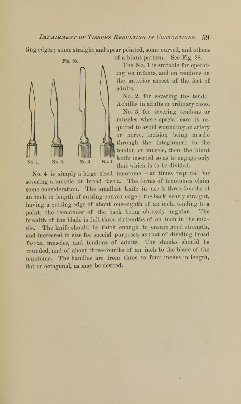 ting edges; some straight and spear pointed, some curved, and others of a blunt pattern. See Fig. 28. The No. 1 is suitable for operat- ing on infants, and on tendons on the anterior aspect of the feet of adults. No. 2, for severing the tendo- Achillis in adults in ordinary cases. No. 3, for severing tendons or muscles where special care is re- quired to avoid wounding an artery or nerve, incision being made through the integument to the tendon or muscle, then the blunt knife inserted so as to engage only that which is to be divided. No. 4 is simply a large sized tenotome — at times required for severing a muscle or broad fascia. The forms of tenotomes claim some consideration. The smallest knife in use is three-fourths of an inch in length of cutting convex edge ; the back nearly straight, having a cutting edge of about one-eighth of an inch, tending to a point, the remainder of the back being obtusely angular. The breadth of the blade is full three-sixteenths of an inch in the mid- dle. The knife should be thick enough to ensure good strength, and increased in size for special purposes, as that of dividing broad fascias, muscles, and tendons of adults. The shanks should be rounded, and of about three-fourths of an inch to the blade of the tenotome. The handles are from three to four inches in length, flat or octagonal, as may be desired.