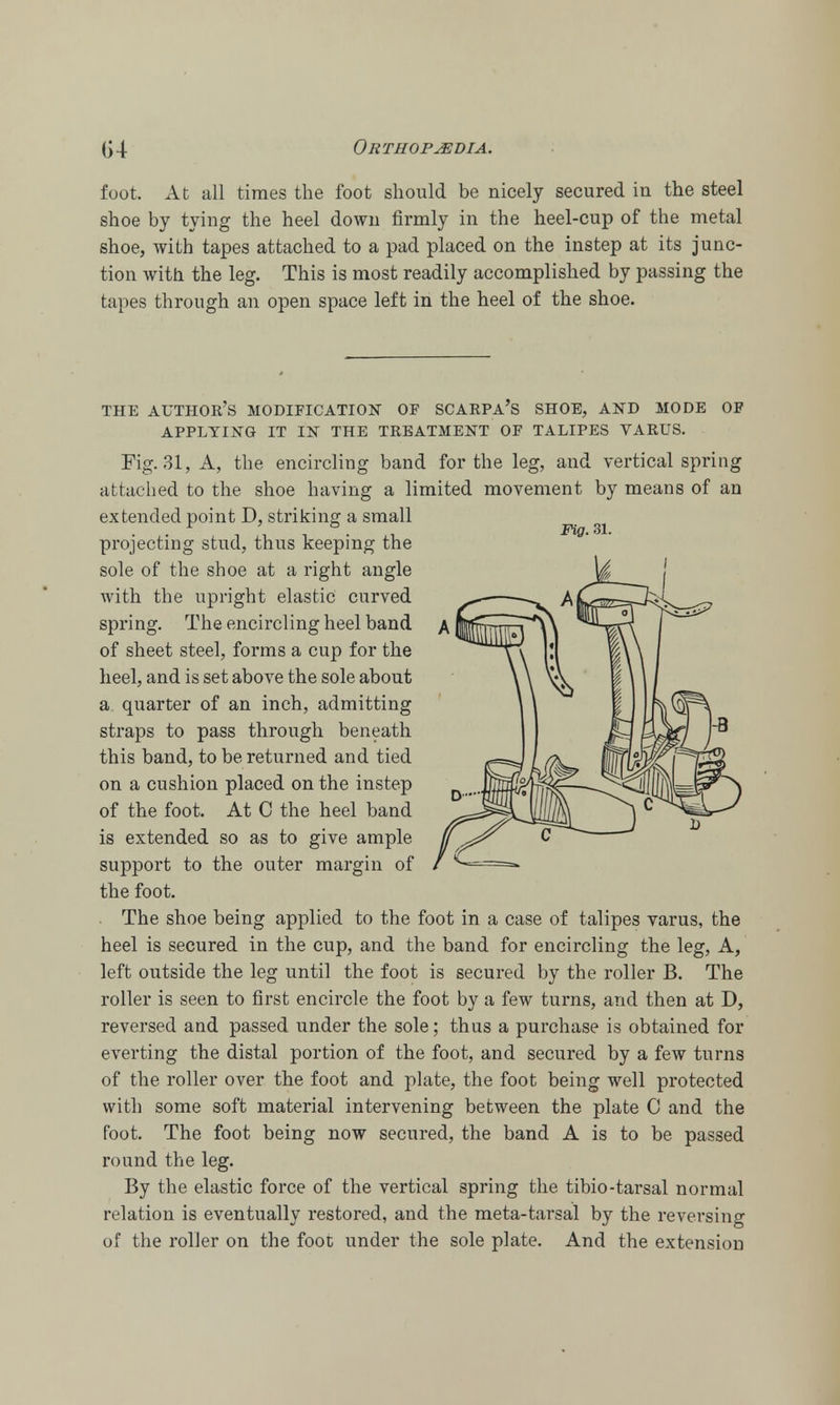 foot. At all times the foot should be nicely secured in the steel shoe by tying the heel down firmly in the heel-cup of the metal shoe, with tapes attached to a pad placed on the instep at its junc- tion with the leg. This is most readily accomplished by passing the tapes through an open space left in the heel of the shoe. THE AUTHOR'S MODIFICATION OF SCARPA'S SHOE, AND MODE OF APPLYING IT IN THE TREATMENT OF TALIPES VARUS. Fig. 31, A, the encircling band for the leg, and vertical spring attached to the shoe having a limited movement by means of an extended point D, striking a small projecting stud, thus keeping the sole of the shoe at a right angle with the upright elastic curved spring. The encircling heel band of sheet steel, forms a cup for the heel, and is set above the sole about a quarter of an inch, admitting straps to pass through beneath this band, to be returned and tied on a cushion placed on the instep of the foot. At C the heel band is extended so as to give ample support to the outer margin of the foot. The shoe being applied to the foot in a case of talipes varus, the heel is secured in the cup, and the band for encircling the leg, A, left outside the leg until the foot is secured by the roller B. The roller is seen to first encircle the foot by a few turns, and then at D, reversed and passed under the sole; thus a purchase is obtained for everting the distal portion of the foot, and secured by a few turns of the roller over the foot and plate, the foot being well protected with some soft material intervening between the plate C and the foot. The foot being now secured, the band A is to be passed round the leg. By the elastic force of the vertical spring the tibio-tarsal normal relation is eventually restored, and the meta-tarsal by the reversing of the roller on the foot under the sole plate. And the extension