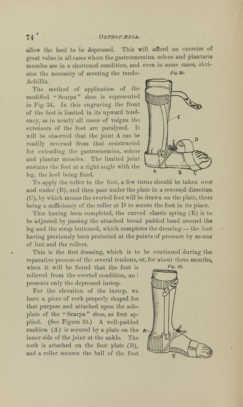 allow the heel to be depressed. This will afford an exercise of great value in all cases where the gastrocnemius, soleus and plantaris muscles are in a shortened condition, and even in some cases, obvi- ates the necessity of severing the tendo- M0.34. Achillis. The method of application of the modified  Scarpa shoe is represented in Fig. 34. In this engraving the front of the foot is limited in its upward tend- ency, as in nearly all cases of valgus the extensors of the foot are paralyzed. It will be observed that the joint A can be readily reversed from that constructed for extending the gastrocnemius, soleus and plantar muscles. The limited joint sustains the foot at a right angle with the leg, the heel being fixed. To apply the roller to the foot, a few turns should be taken over and under (B), and then pass under the plate in a reversed direction (C), by which means the everted foot will be drawn on the plate, there being a sufficiency of the roller at D to secure the foot in its place. This having been completed, the curved elastic spring (E) is to be adjusted by passing the attached broad padded band around the leg and the strap buttoned, which completes the dressing— the foot having previously been protected at the points of pressure by means of lint and the rollers. This is the first dressing, which is to be continued during the reparative process of the several tendons, or, for about three months, when it will be found that the foot is relieved from the everted condition, an i wfc ^Ji presents only the depressed instep. tlullffnTFw For the elevation of the instep, we have a piece of cork properly shaped for [ / that purpose and attached upon the sole- W I plate of the  Scarpa shoe, as first ap- pt / plied. (See Figure 35.) A well-padded f| I cushion (A) is secured by a plate on the A^J|, ])$^ inner side of the joint at the ankle. The cork is attached on the foot plate (B), and a roller secures the ball of the foot