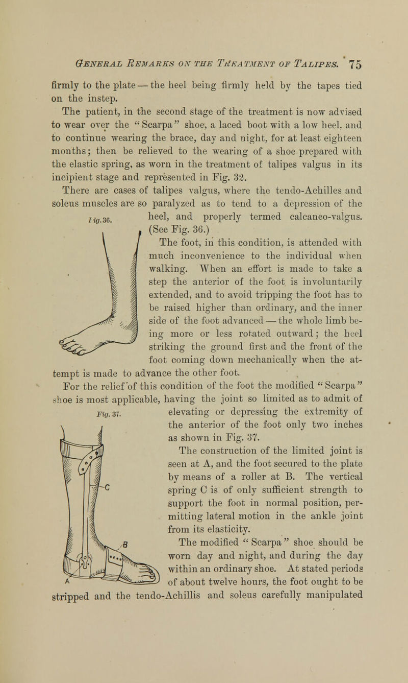 firmly to the plate — the heel being firmly held by the tapes tied on the instep. The patient, in the second stage of the treatment is now advised to wear over the  Scarpa shoe, a laced boot with a low heel, and to continue wearing the brace, day and night, for at least eighteen months; then be relieved to the wearing of a shoe prepared with the elastic spring, as worn in the treatment of talipes valgus in its incipient stage and represented in Fig. 32. There are cases of talipes valgus, where the tendo-Achilles and soleus muscles are so paralyzed as to tend to a depression of the H0.36. heel, and projjerly termed calcaneo-valgus. (See Fig. 36.) The foot, in this condition, is attended with much inconvenience to the individual when walking. When an effort is made to take a step the anterior of the foot is involuntarily extended, and to avoid tripping the foot has to be raised higher than ordinary, and the inner side of the foot advanced — the whole limb be- ing more or less rotated outward; the heel striking the ground first and the front of the foot coming down mechanically when the at- tempt is made to advance the other foot. For the relief'of this condition of the foot the modified  Scarpa shoe is most applicable, having the joint so limited as to admit of elevating or depressing the extremity of the anterior of the foot only two inches as shown in Fig. 37. The construction of the limited joint is seen at A, and the foot secured to the plate by means of a roller at B. The vertical spring C is of only sufficient strength to support the foot in normal position, per- mitting lateral motion in the ankle joint from its elasticity. The modified  Scarpa  shoe should be worn day and night, and during the day within an ordinary shoe. At stated periods of about twelve hours, the foot ought to be stripped and the tendo-Achillis and soleus carefully manipulated
