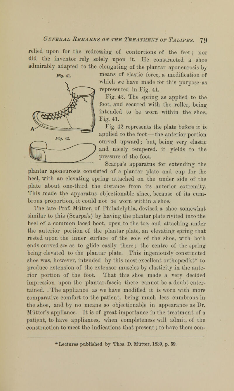 relied upon for the redressing of contortions of the feet; nor did the inventor rely solely upon it. He constructed a shoe admirably adapted to the elongating of the plantar aponeurosis by Fig. 41. means of elastic force, a modification of which Ave have made for this purpose as represented in Fig. 41. Fig. 42. The spring as applied to the foot, and secured with the roller, being intended to be worn within the shoe, Fig. 41. Fig. 42 represents the plate before it is applied to the foot — the anterior portion curved upward; but, being very elastic and nicely tempered, it yields to the pressure of the foot. Scarpa's apparatus for extending the plantar aponeurosis consisted of a plantar plate and cup for the heel, with an elevating spring attached on the under side of the plate about one-third the distance from its anterior extremity. This made the apparatus objectionable since, because of its cum- brous proportion, it could not be worn within a shoe. The late Prof. Mutter, of Philadelphia, devised a shoe somewhat similar to this (Scarpa's) by having the plantar plate rivited into the heel of a common laced boot, open to the toe, and attaching under the anterior portion of the plantar plate, an elevating spring that rested upon the inner surface of the sole of the shoe, with both ends curved so* as to glide easily there; the centre of the spring being elevated to the plantar plate. This ingeniously constructed shoe was, however, intended by this most excellent orthopaedist* to produce extension of the extensor muscles by elasticity in the ante- rior portion of the foot. That this shoe made a very decided impression upon the plantar-fascia there cannot be a doubt enter- tained. . The appliance as we have modified it is worn with more comparative comfort to the patient, being much less cumbrous in the shoe, and by no means so objectionable in appearance as Dr. Mutter's appliance. It is of great importance in the treatment of a pati.ent, to have appliances, when completeness will admit, of the construction to meet the indications that present; to have them con- * Lectures published by Thos. D. Mutter, 1839, p. 59.