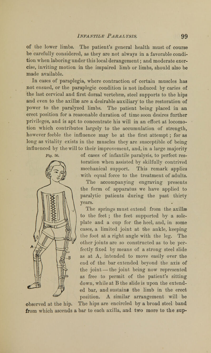 of the lower limbs. The patient's general health must of course be carefully considered, as they are not always in a favorable condi- tion when laboring under this local derangement; and moderate exer- cise, inviting motion in the impaired limb or limbs, should also be made available. In cases of paraplegia, where contraction of certain muscles has not ensued, or the paraplegic condition is not induced by caries of the last cervical and first dorsal vertebrae, steel supports to the hips and even to the axillae are a desirable auxiliary to the restoration of power to the paralyzed limbs. The patient being placed in an erect position for a reasonable duration of time soon desires further privileges, and is apt to concentrate his will in an effort at locomo- tion which contributes largely to the accumulation of strength, however feeble the influence may be at the first attempt; for as long as vitality exists in the muscles they are susceptible of being influenced by the will to their improvement, and, in a large majority Fig. 50. of cases of infantile paralysis, to perfect res- toration when assisted by skilfully contrived mechanical support. This remark applies with equal force to the treatment of adults. The accompanying engraving presents the form of apparatus we have applied to paralytic patients during the past thirty years. The springs must extend from the axillae to the feet ; the feet supported by a sole- plate and a cup for the heel, and, in some cases, a limited joint at the ankle, keeping the foot at a right angle with the leg. The other joints are so constructed as to be per- fectly fixed by means of a strong steel slide as at A, intended to move easily over the end of the bar extended beyond the axis of the joint — the joint being now represented as free to permit of the patient's sitting down, while at B the slide is upon the extend- ed bar, and sustains the limb in the erect position. A similar arrangement will be observed at the hip. The hips are encircled by a broad steel band from which ascends a bar to each axilla, and two more to the sup-