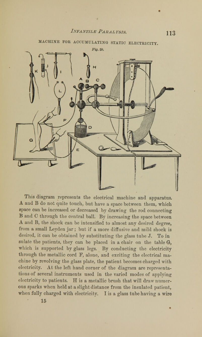 MACHINE FOE ACCUMULATING STATIC ELECTKICITT. Fig. 59. This diagram represents the electrical machine and apparatus. A and B do not quite touch, but have a space between them, which space can be increased or decreased by drawing the rod connecting B and C through the central ball. By increasing the space between A and B, the shock can be intensified to almost any desired degree, from a small Leyden jar; but if a more diffusive and mild shock is desired, it can be obtained by substituting the glass tube J. To in sulate the patients, they can be placed in a chair on the table G, which is supported by glass legs. By conducting the electricity through the metallic cord F, alone, and exciting the electrical ma- chine by revolving the glass plate, the patient becomes charged with electricity. At the left hand corner of the diagram are representa- tions of several instruments used in the varied modes of applying electricity to patients. H is a metallic brush that will draw numer- ous sparks when held at a slight distance from the insulated patient, when fully charged with electricity. I is a glass tube having a wire 15