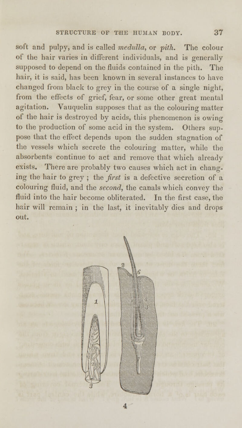 soft and pulpy, and is called medulla, or pith. The colour of the hair varies in different individuals, and is generally supposed to depend on the fluids contained in the pith. The hair, it is said, has been known in several instances to have changed from black to grey in the course of a single night, from the effects of grief, fear, or some other great mental agitation. Vauquelin supposes that as the colouring matter of the hair is destroyed by acids, this phenomenon is owing to the production of some acid in the system. Others sup- pose that the effect depends upon the sudden stagnation of the vessels which secrete the colouring matter, while the absorbents continue to act and remove that which already exists. There are probably two causes which act in chang- ing the hair to grey ; the first is a defective secretion of a colouring fluid, and the second, the canals which convey the fluid into the hair become obliterated. In the first case, the hair will remain ; in the last, it inevitably dies and drops out.