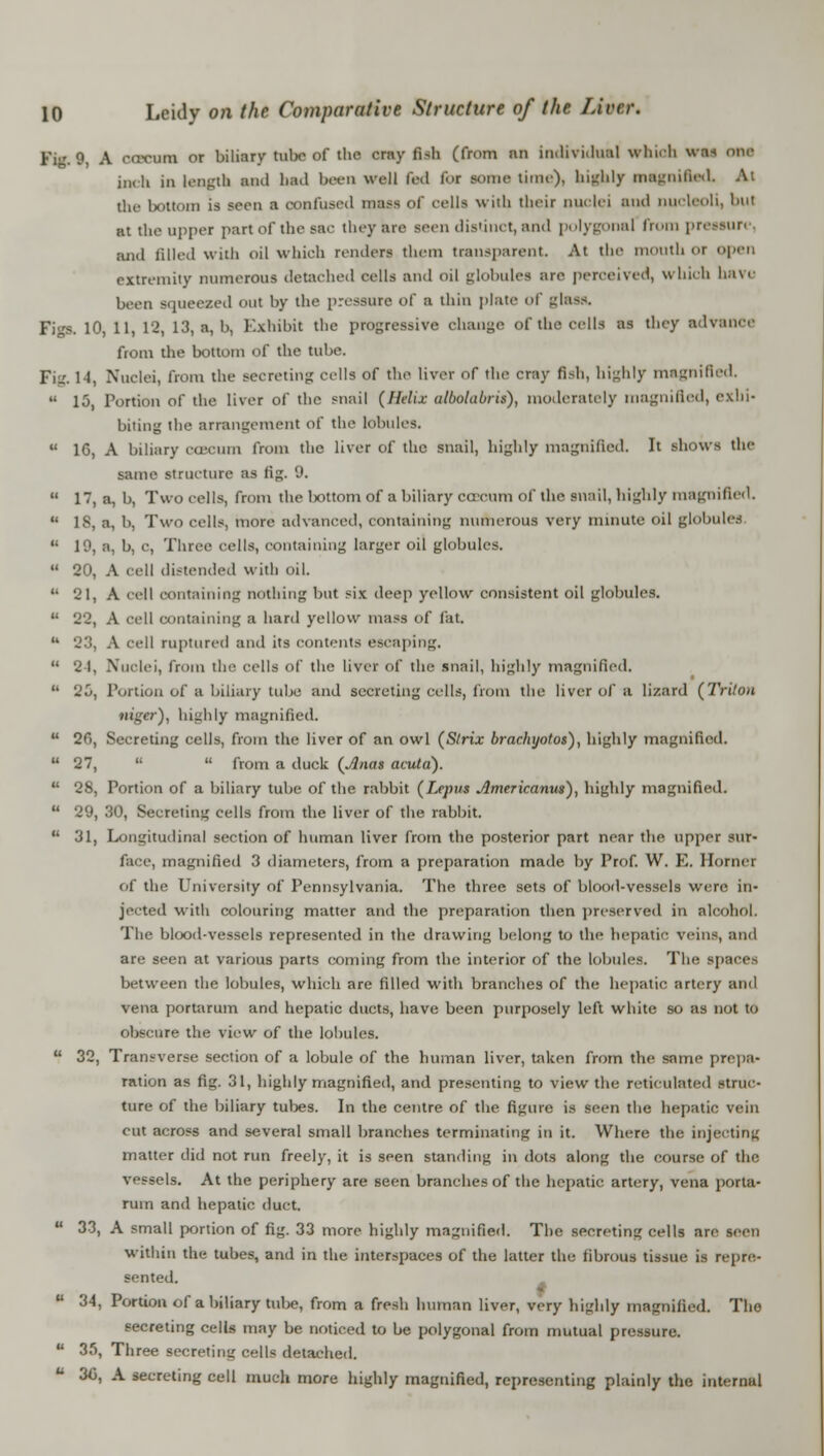 Fi. 9 A OOecWB or biliary tube of the crayfish (from an Individual winch urn one inch in length and bad been well t.-d for some time)- highly magnified die bottom is seen a confused mau of cella with their nuclei ami nucleoli, but at the upper part of the sac they are Been distinct, and polygonal fi pressuri and tilled with oil whieh renders them transparent At the mOUtb or open extremity numerous detached cells and oil globules are perceived, which have been squeezed out by the pressure of a thin plate- of ula->. Figs, 10, 11, 12, 13, a, b, Exhibit the progressive change of the cells as they advance from the bottom of the tube. Fiu'. H, Nuclei, from the secreting cells of the liver of the cray fish, highly magnified,  15 Fortion of the liver of the snail (Helix ulbolabris), moderately magnified, exhi- biting the arrangement of the lobules.  16, A biliary CCSCUm from the liver of the snail, highly magnified. It shows the same structure as fig. 9.  17, a, b, Two cells, from the Ixrttom of a biliary coecum of the snail, highly magnified.  18, a, b, Two cells, more advanced, containing numerous very minute oil globules  19, a, b, c, Three cells, containing larger oil globules.  20, A cell distended with oil.  21, A cell containing nothing but six deep yellow consistent oil globules.  22, A cell containing a hard yellow mass of fat.  23, A cell ruptured and its contents escaping.  21, Nuclei, from the cells of the liver of the snail, highly magnified.  25, Portion of a biliary tube and secreting cells, from the liver of a lizard (Triton niger), highly magnified  20, Secreting cells, from the liver of an owl (Slrix brachyotos), highly magnified.  27,   from a duck (Anas acuta). u 28, Portion of a biliary tube of the rabbit (T-epus Americanus), highly magnified.  29, 30, Secreting cells from the liver of the rabbit.  31, Longitudinal section of human liver from the posterior part near the upper sur- face, magnified 3 diameters, from a preparation made by Prof. W. E. Home] of the University of Pennsylvania. The three sets of blood-vessels were in- jected with colouring matter and the preparation then preserved in alcohol. The blood-vessels represented in the drawing belong to the hepatic veins, and are seen at various parts coming from the interior of the lobules. The spacei between the lobules, which are rilled with branches of the hepatic artery and vena portarum and hepatic ducts, have been purposely left white so as not to obscure the view of the lobules.  32, Transverse section of a lobule of the human liver, taken from the same prepa- ration as fig. 31, highly magnified, and presenting to view the reticulated struc- ture of the biliary tubes. In the centre of the figure is seen the hepatic vein cut across and several small branches terminating in it. Where the injecting matter did not run freely, it is seen standing in dots along the course of the vessels. At the periphery are seen branches of the hepatic artery, vena porta- rum and hepatic duct.  33, A small portion of fig. 33 more highly magnified. The secreting cells are seen within the tubes, and in the interspaces of the latter the fibrous tissue is repre- sented.  34, Portion of a biliary tube, from a fresh human liver, very highly magnified. The secreting cells may be noticed to be polygonal from mutual pressure. u 35, Three secreting cells detached. u 3G, A secreting cell much more highly magnified, representing plainly the internal