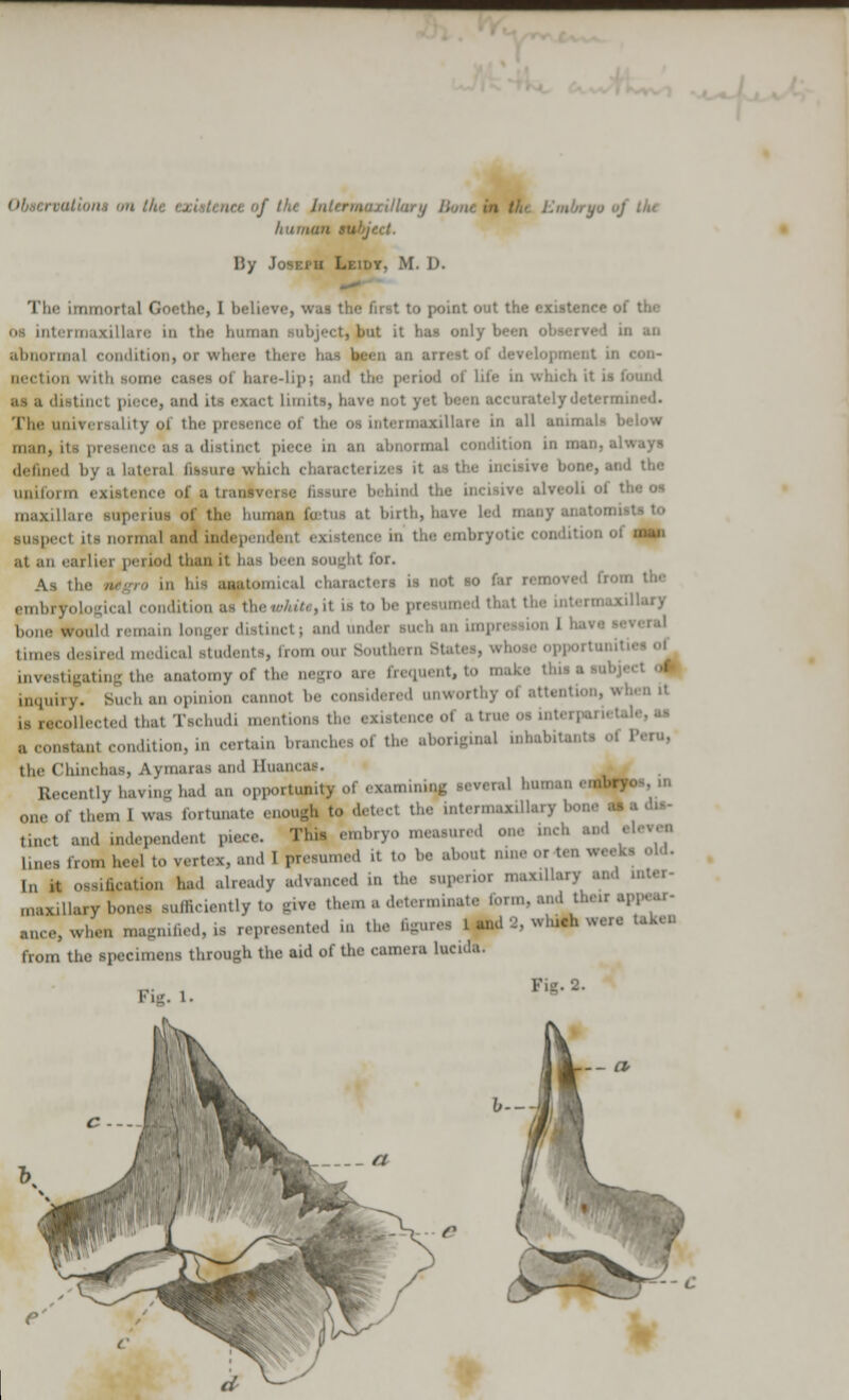 It it man subject. Bj ' ■ i a Li lot, M. D. Tin' immortal Goethe, I believe, was the first to point out the existence a Ofl 1111 < 1111.1x11 l.ii ■: in the '. but it has only been in an abnormal condition] or where tl ion with some cases of hare-lip; and the period i life in which it it (bond aa a d limits, have not yet b< elydetermii The universality of the | rillare in all ■nimali below man. in an abnormal condition in man, always defined by a lateral fissure which chai ;,1C uniform existence of a trai behind the incisive alveoli oi the os maxillare superius of the human fetus at birth, have led man] peel its normal and independent existence in the embryotic condition of man at an earlier period than it has been Bought for. As the negro in his ssatomical characters is not so hi ramoTed fr embryological condition as the whiti. it is to be presumed tl bone* tinctj and undei inch an in times desired medical students, from o ,,,.., tte anatomy of the oegro an frequent, to m inquiry. Such an opii annot be considered nnwortlrj • ■ ll is recollected that Tschudi mentions the existence of atru a constant condition, in certain branches of the aborigiiial inhal the Chinchas, Aymaras and Huancas. Recently having had an opportunity ol examining several human « one of them I was fortunate enough to detect the intermaxillary I tinct and independent piece. Tins embryo measured one inch and eleven lines from heel to vertex, and 1 presumed it to be about nine or ten weeks old. |„ lt ossification had already advanced in the Wperioi maxUlarj and , maxillary bones sufficiently to give them a determinate form, and theirs ance, when magnified, is represented in the figures Land 2, whit* were te from the specimens through the aid of the camera lucida. Fur. i.
