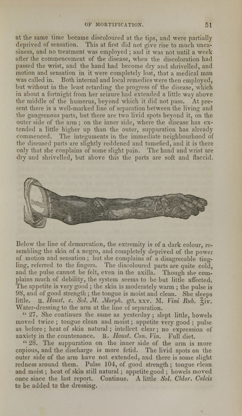 at the same time became discoloured at the tips, and were partially deprived of sensation. This at first did not give rise to much unea- siness, and no treatment was employed ; and it was not until a week after the commencement of the disease, when the discoloration had passed the wrist, and the hand had become dry and shrivelled, and motion and sensation in it were completely lost, that a medical man was called in. Both internal and local remedies were then employed, but without in the least retarding the progress of the disease, which in about a fortnight from her seizure had extended a little way above the middle of the humerus, beyond which it did not pass. At pre- sent there is a well-marked line of separation between the living and the gangrenous parts, but there are two livid spots beyond it, on the outer side of the arm ; on the inner side, where the disease has ex- tended a little higher up than the outer, suppuration has already commenced. The integuments in the immediate neighbourhood of the diseased parts are slightly reddened and tumefied, and it is there only that she conplains of some slight pain. The hand and wrist are dry and shrivelled, but above this the parts are soft and flaccid. Below the line of demarcation, the extremity is of a dark colour, re- sembling the skin of a negro, and completely deprived of the power of motion and sensation ; but she complains of a disagreeable ting- ling, referred to the fingers. The discoloured parts are quite cold, and the pulse cannot be felt, even in the axilla. Though she com- plains much of debility, the system seems to be but little affected. The appetite is very good ; the skin is moderately warm ; the pulse is 98, and of good strength ; the tongue is moist and clean. She sleeps little. K. Haust. c. Sol. M. Morph. gtt. xxv. M. Vini Rub. |iv. Water-dressing to the arm at the line of separation.  27. She continues the same as yesterday ; slept little, bowels moved twice ; tongue clean and moist; appetite very good ; pulse as before ; heat of skin natural ; intellect clear; no expression of anxiety in the countenance. R. Haust. Con. Vin. Full diet.  28. The suppuration on the inner side of the arm is more copious, and the discharge is more fetid. The livid spots on the outer side of the arm have not extended, and there is some slight redness around them. Pulse 104, of good strength ; tongue clean and moist; heat of skin still natural ; appetite good ; bowels moved once since the last report. Continue. A little Sol. Chlor. Calcis to be added to the dressing.
