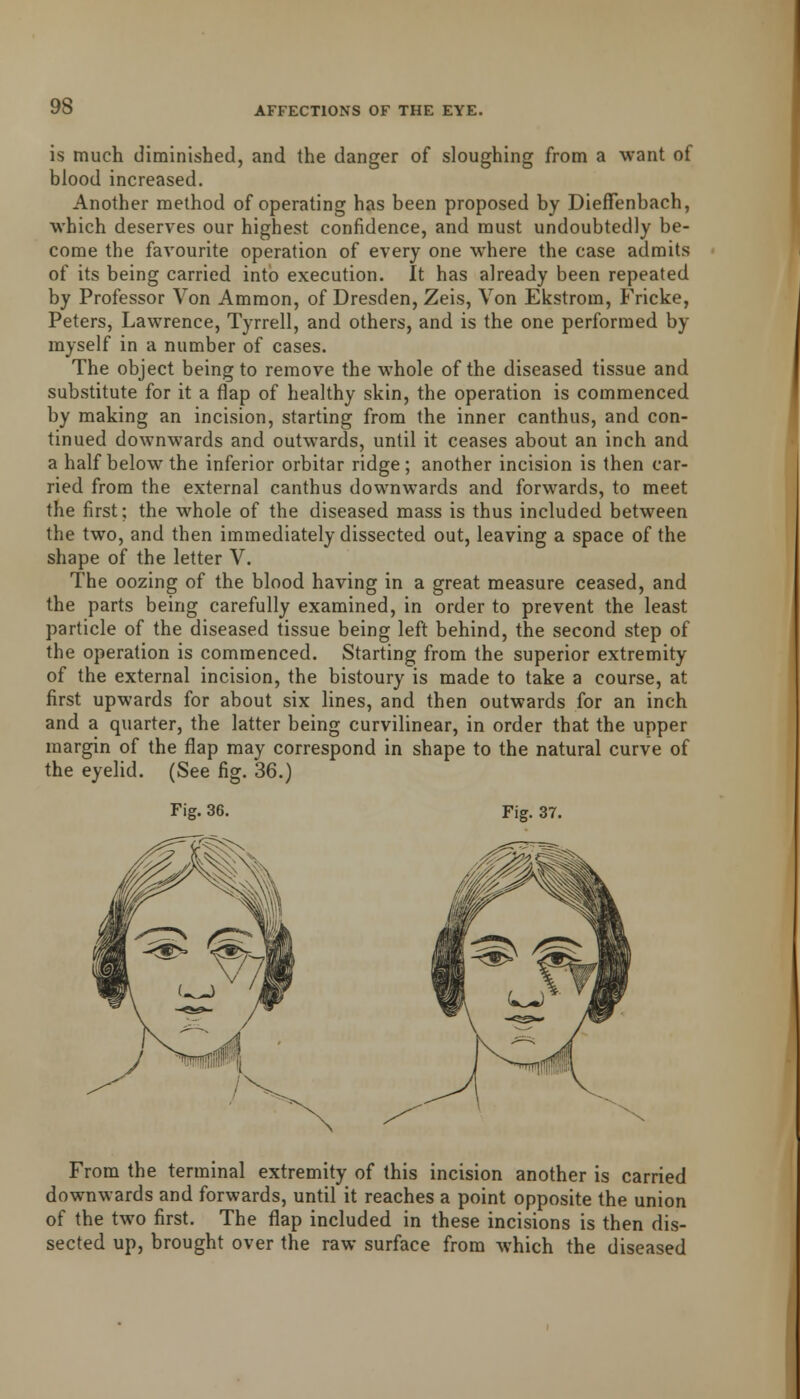 is much diminished, and the danger of sloughing from a want of blood increased. Another method of operating has been proposed by Dieffenbach, which deserves our highest confidence, and must undoubtedly be- come the favourite operation of every one where the case admits of its being carried into execution. It has already been repeated by Professor Von Ammon, of Dresden, Zeis, Von Ekstrom, Fricke, Peters, Lawrence, Tyrrell, and others, and is the one performed by myself in a number of cases. The object being to remove the whole of the diseased tissue and substitute for it a flap of healthy skin, the operation is commenced by making an incision, starting from the inner canthus, and con- tinued downwards and outwards, until it ceases about an inch and a half below the inferior orbitar ridge ; another incision is then car- ried from the external canthus downwards and forwards, to meet the first; the whole of the diseased mass is thus included between the two, and then immediately dissected out, leaving a space of the shape of the letter V. The oozing of the blood having in a great measure ceased, and the parts being carefully examined, in order to prevent the least particle of the diseased tissue being left behind, the second step of the operation is commenced. Starting from the superior extremity of the external incision, the bistoury is made to take a course, at first upwards for about six lines, and then outwards for an inch and a quarter, the latter being curvilinear, in order that the upper margin of the flap may correspond in shape to the natural curve of the eyelid. (See fig. 36.) Fig. 36. Fig. 37. From the terminal extremity of this incision another is carried downwards and forwards, until it reaches a point opposite the union of the two first. The flap included in these incisions is then dis- sected up, brought over the raw surface from which the diseased
