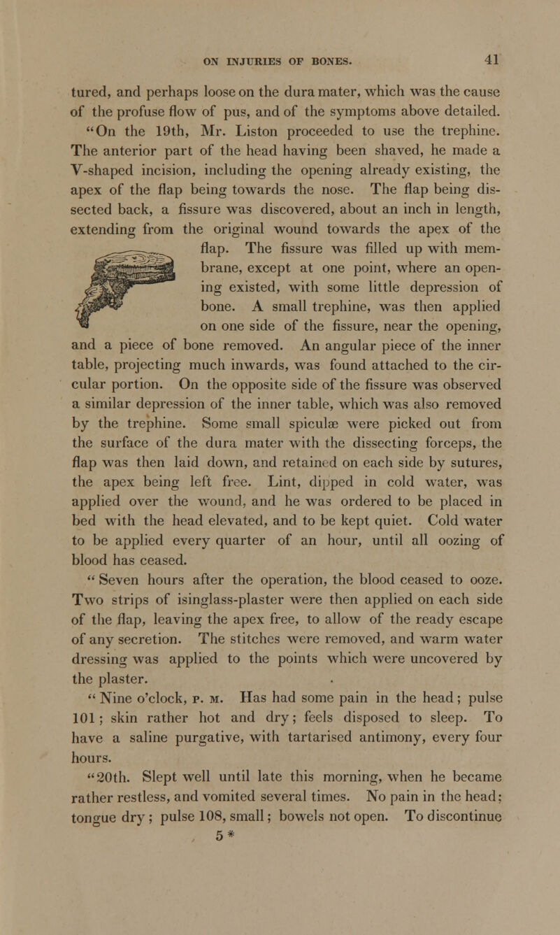 tured, and perhaps loose on the dura mater, which was the cause of the profuse flow of pus, and of the symptoms above detailed. On the 19th, Mr. Liston proceeded to use the trephine. The anterior part of the head having been shaved, he made a V-shaped incision, including the opening already existing, the apex of the flap being towards the nose. The flap being dis- sected back, a fissure was discovered, about an inch in length, extending from the original wound towards the apex of the flap. The fissure was filled up with mem- brane, except at one point, where an open- ing existed, with some little depression of bone. A small trephine, was then applied on one side of the fissure, near the opening, and a piece of bone removed. An angular piece of the inner table, projecting much inwards, was found attached to the cir- cular portion. On the opposite side of the fissure was observed a similar depression of the inner table, which was also removed by the trephine. Some small spiculae were picked out from the surface of the dura mater with the dissecting forceps, the flap was then laid down, and retained on each side by sutures, the apex being left free. Lint, dipped in cold water, was applied over the wound, and he was ordered to be placed in bed with the head elevated, and to be kept quiet. Cold water to be applied every quarter of an hour, until all oozing of blood has ceased.  Seven hours after the operation, the blood ceased to ooze. Two strips of isinglass-plaster were then applied on each side of the flap, leaving the apex free, to allow of the ready escape of any secretion. The stitches were removed, and warm water dressing was applied to the points which were uncovered by the plaster.  Nine o'clock, p. m. Has had some pain in the head; pulse 101; skin rather hot and dry; feels disposed to sleep. To have a saline purgative, with tartarised antimony, every four hours. 20th. Slept well until late this morning, when he became rather restless, and vomited several times. No pain in the head; tongue dry; pulse 108, small; bowels not open. To discontinue 5*