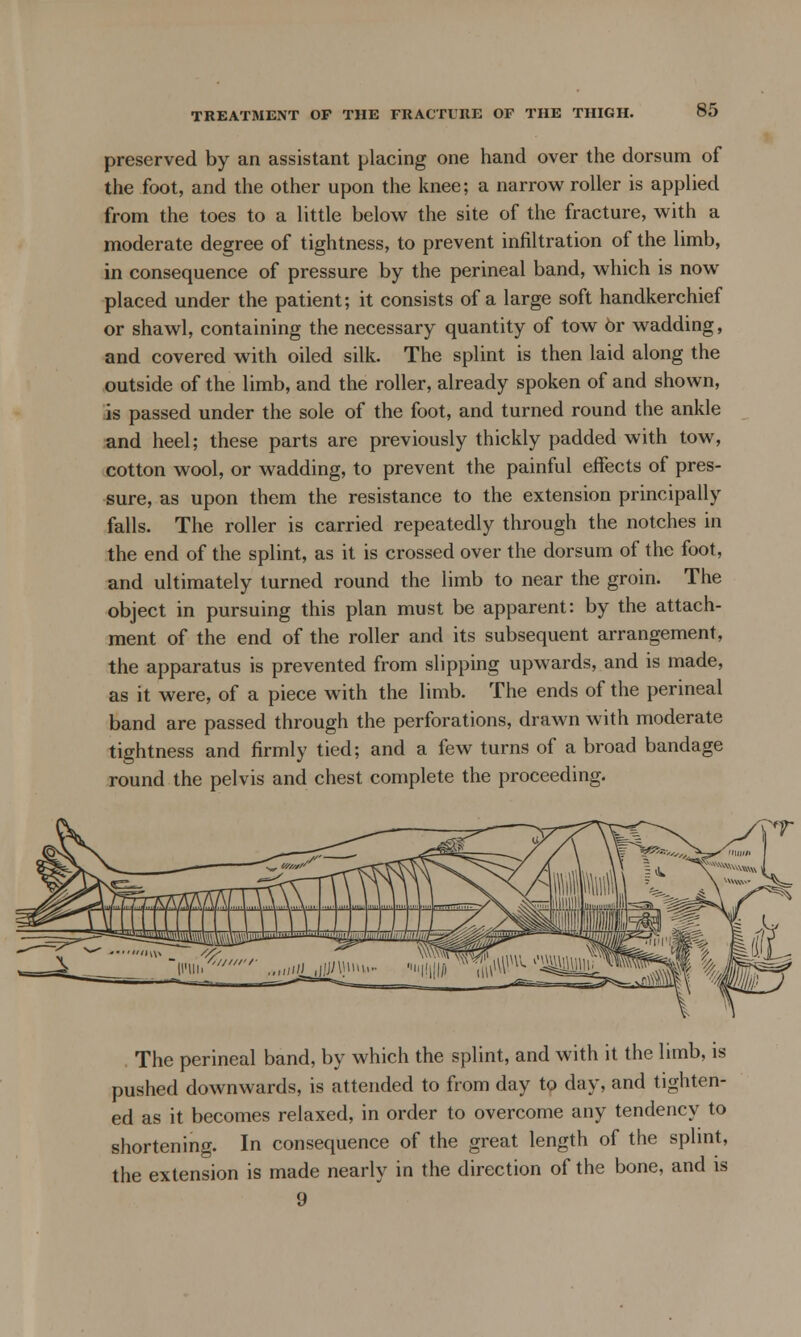 preserved by an assistant placing one hand over the dorsum of the foot, and the other upon the knee; a narrow roller is applied from the toes to a little below the site of the fracture, with a moderate degree of tightness, to prevent infiltration of the limb, in consequence of pressure by the perineal band, which is now placed under the patient; it consists of a large soft handkerchief or shawl, containing the necessary quantity of tow 6r wadding, and covered with oiled silk. The splint is then laid along the outside of the limb, and the roller, already spoken of and shown, is passed under the sole of the foot, and turned round the ankle and heel; these parts are previously thickly padded with tow, cotton wool, or wadding, to prevent the painful effects of pres- sure, as upon them the resistance to the extension principally falls. The roller is carried repeatedly through the notches in the end of the splint, as it is crossed over the dorsum of the foot, and ultimately turned round the limb to near the groin. The object in pursuing this plan must be apparent: by the attach- ment of the end of the roller and its subsequent arrangement, the apparatus is prevented from slipping upwards, and is made, as it were, of a piece with the limb. The ends of the perineal band are passed through the perforations, drawn with moderate tightness and firmly tied; and a few turns of a broad bandage round the pelvis and chest complete the proceeding. The perineal band, by which the splint, and with it the limb, is pushed downwards, is attended to from day to day, and tighten- ed as it becomes relaxed, in order to overcome any tendency to shortening. In consequence of the great length of the splint, the extension is made nearly in the direction of the bone, and is 9