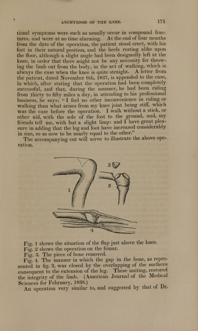 tional symptoms were such as usually occur in compound frac- tures, and were at no time alarming. At the end of four months from the date of the operation, the patient stood erect, with his feet in their natural position, and the heels resting alike upon the floor, although a slight angle had been designedly left at the knee, in order that there might not be any necessity for throw- ing the limb out from the body, in the act of walking, which is always the case when the knee is quite straight. A letter from the patient, dated November 6th, 1837, is appended to the case, in which, after stating that the operation had been completely successful, and that, during the summer, he had been riding from thirty to fifty miles a day, in attending to his professional business, he says; I feel no other inconvenience in riding or walking than what arises from my knee joint being stiff, which was the case before the operation. I walk without a stick, or other aid, with the sole of the foot to the ground, and, my friends tell me, with but a slight limp: and I have great plea- sure in adding that the leg and foot have increased considerably in size, so as now to be nearly equal to the other. The accompanying cut will serve to illustrate the above ope- ration. Fig. 1 shows the situation of the flap just above the knee. Fig. 2 shows the operation on the femur. Fig. 3. The piece of bone removed. Fig. 4. The manner in which the gap in the bone, as repre- sented in fig. 2, was closed by the overlapping of the surfaces consequent to the extension of the leg. These uniting, restored the integrity of the limb. (American Journal of the Medical Sciences for February, 1838.) An operation very similar to, and suggested by that ol Dr.