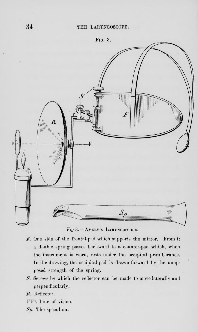 Fig. 3. Fig 3.—Avery's Laryngoscope. F. One side of the frontal-pad which supports the mirror. From it a double spring passes backward to a counter-pad which, when the instrument is worn, rests under the occipital protuberance. In the drawing, the occipital-pad is drawn forward by the unop- posed strength of the spring. S. Screws by which the reflector can be made to move laterally and perpendicularly. E. Reflector. VV1. Line of vision. Sp. The speculum.