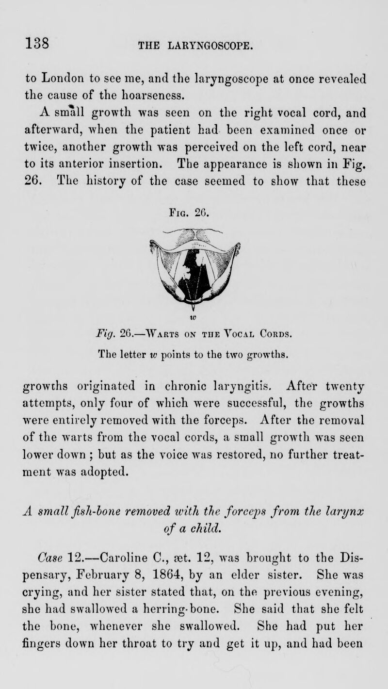 to London to see me, and the laryngoscope at once revealed the cause of the hoarseness. A small growth was seen on the right vocal cord, and afterward, when the patient had been examined once or twice, another growth was perceived on the left cord, near to its anterior insertion. The appearance is shown in Fig. 26. The history of the case seemed to show that these Fig. 26. Fig. 26.—Warts on the Vocal Cords. The letter w points to the two growths. growths originated in chronic laryngitis. After twenty attempts, only four of which were successful, the growths were entirely removed with the forceps. After the removal of the warts from the vocal cords, a small growth was seen lower down ; but as the voice was restored, no further treat- ment was adopted. A small fish-bone removed with the forceps from the larynx of a child. Case 12.—Caroline C, set. 12, was brought to the Dis- pensary, February 8, 1864, by an elder sister. She was crying, and her sister stated that, on the previous evening, she had swallowed a herring-bone. She said that she felt the bone, whenever she swallowed. She had put her fingers down her throat to try and get it up, and had been
