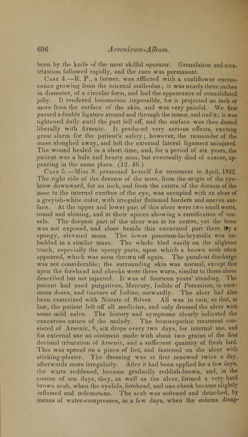 been by the knife of the most skilful operator. Granulation and cica- trization followed rapidly, and the cure was permanent. Case 4.—R. P., a farmer, was afflicted with a cauliflower excres- cence growing from the internal malleolus; it was nearly three inches in diameter, of a circular form, and had the appearance of consolidated jelly. It rendered locomotion impossible, for it projected an inch or more from the surface of the skin, and was very painful. We first passed a double ligature around and through the tumor, and tied it; it was tightened daily until the part fell off. and the surface was then dusted liberally with Arsenic. It produced very serious effects, exciting great alarm for the patient's safety; however, the remainder of the mass sloughed away, and left the external lateral ligament uninjured. The wound healed in a short time, and, for a period of six years, the patient was a hale and hearty man, but eventually died of cancer, ap- pearing in the same place. (12. 46.) Casf, 5.—Miss S. presented herself for treatment in April, 1842. The right side of the dorsum of the nose, from the origin of the eye- brow downward, for an inch, and from the centre of the dorsum of the nose to the internal canthus of the eye, was occupied with an nicer of a greyish-white color, with irregular flattened borders and uneven sur- face. At the upper and lower part of this ulcer were two small warts, round and shining, and at their apices showing a ramification of ves- sels. The deepest part of the ulcer was at its centre, yet the bone was not exposed, and close beside this excavated part there lfy a spongy, elevated mass. The lower punctum-lachrymalis was im- bedded in a similar mass. The whole bled easily on the slightest touch, especially the spongy parts, upon which a brown scab often appeared, which was soon thrown off again. The purulent discharge was not considerable; the surrounding skin was normal, except that upon the forehead and cheeks were three warts, similar to those above described but not injected. It was of fourteen years' standing. The patient had used purgatives, Mercury, Iodide of Potassium, in enor- mous doses, and tincture of Iodine, outwardly. The ulcer had also been cauterized with Nitrate of Silver. All was in vain, so that, at last, the patient left off all medicine, and only dressed the ulcer with some mild salve. The history and symptoms clearly indicated the cancerous nature of the malady. The homoeopathic treatment con- sisted of Arsenic, 8, six drops every two days, for internal use, and for- external use an ointment made with about two grains of the first decimal trituration of Arsenic, and a sufficient quantity of fresh lard. This was spread on a piece of lint, and fastened on the ulcer with sticking-plaster. The dressing was at first renewed twice a day, afterwards more irregularly. After it had been applied for a few days, the warts reddened, became gradually reddish-brown, and, in the course of ten days, they, as well as the ulcer, formed a very hard brown scab, when the eyelids, forehead, and one cheek became slightly inflamed and ogdematous. The scab was softened and detached, by means of water-compresses, in a few days, when the cedema disap-