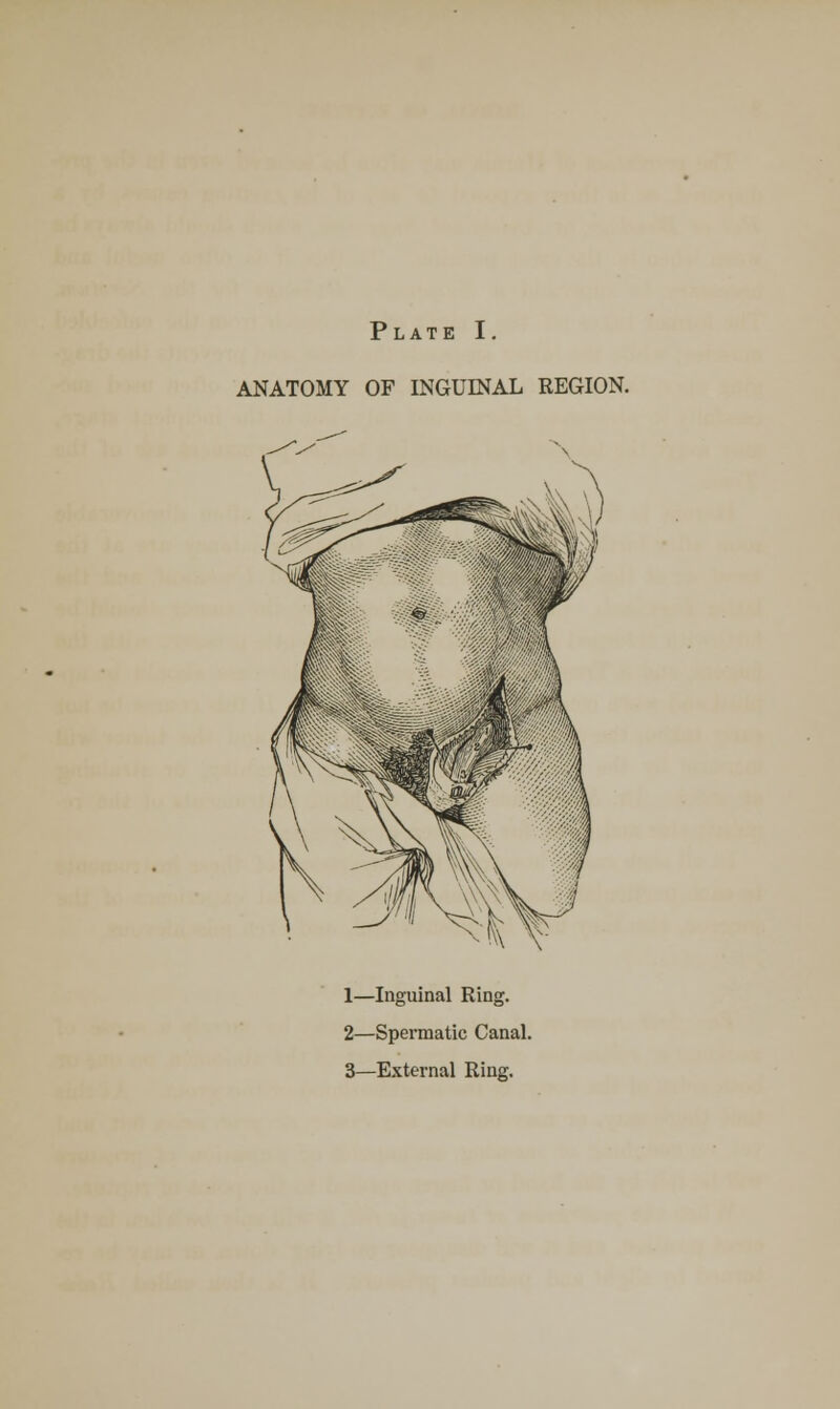 ANATOMY OF INGUINAL REGION. 1—Inguinal Ring. 2—Spermatic Canal. 3—External Ring.