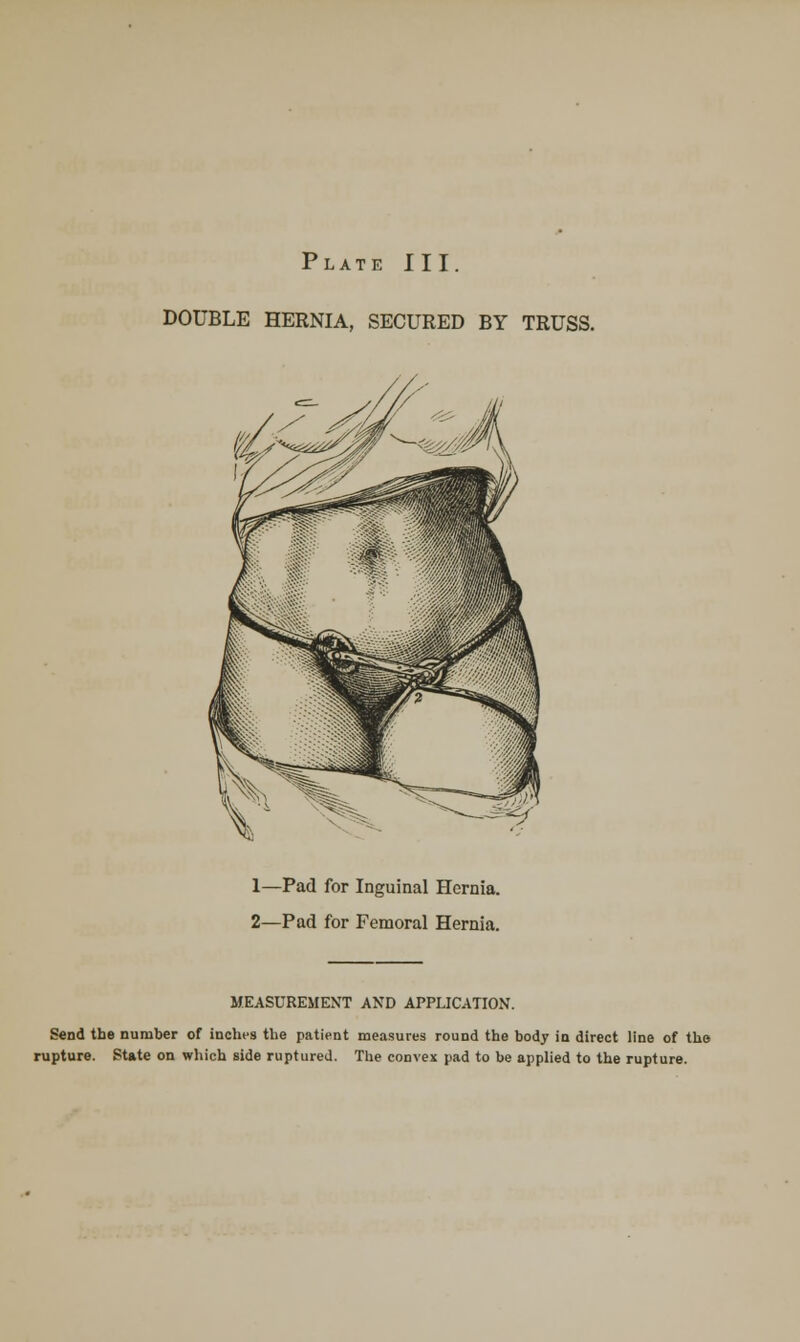 DOUBLE HERNIA, SECURED BY TRUSS. 1—Pad for Inguinal Hernia. 2—Pad for Femoral Hernia. MEASUREMENT AND APPLICATION'. Send the number of inches the patient measures round the body in direct line of the rupture. State on which side ruptured. The convex pad to be applied to the rupture.
