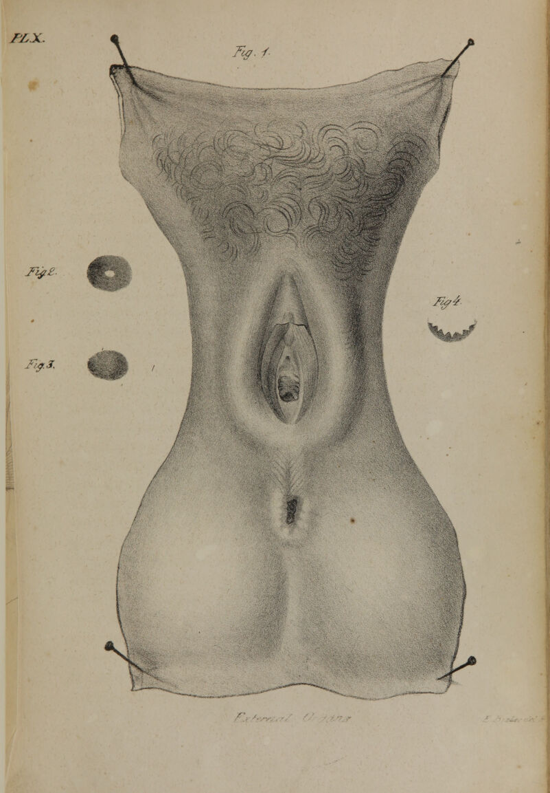 Fig.j. f Jfy£. Fia.3. I Ii#4- / £